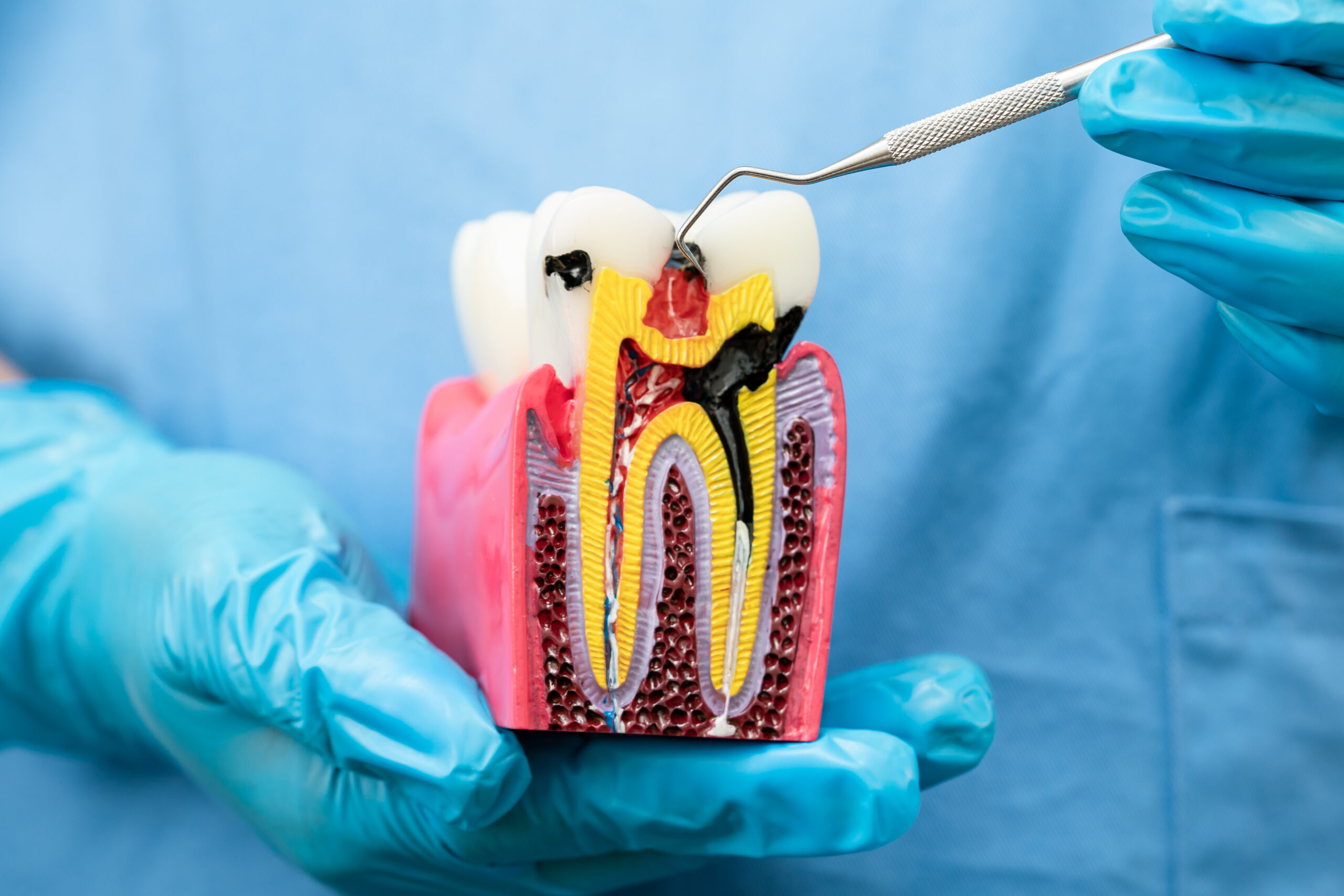 price for root canal