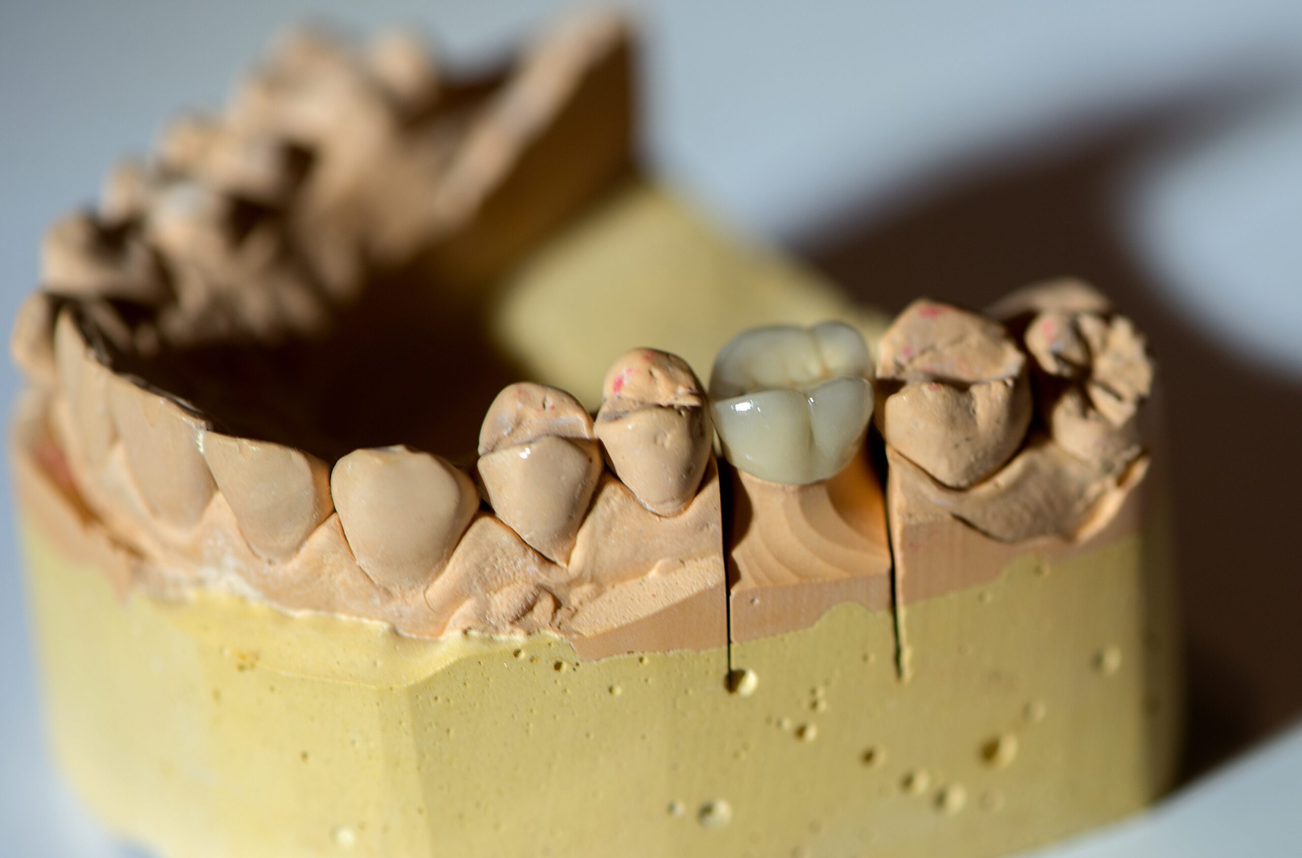 how much is it to cap a tooth