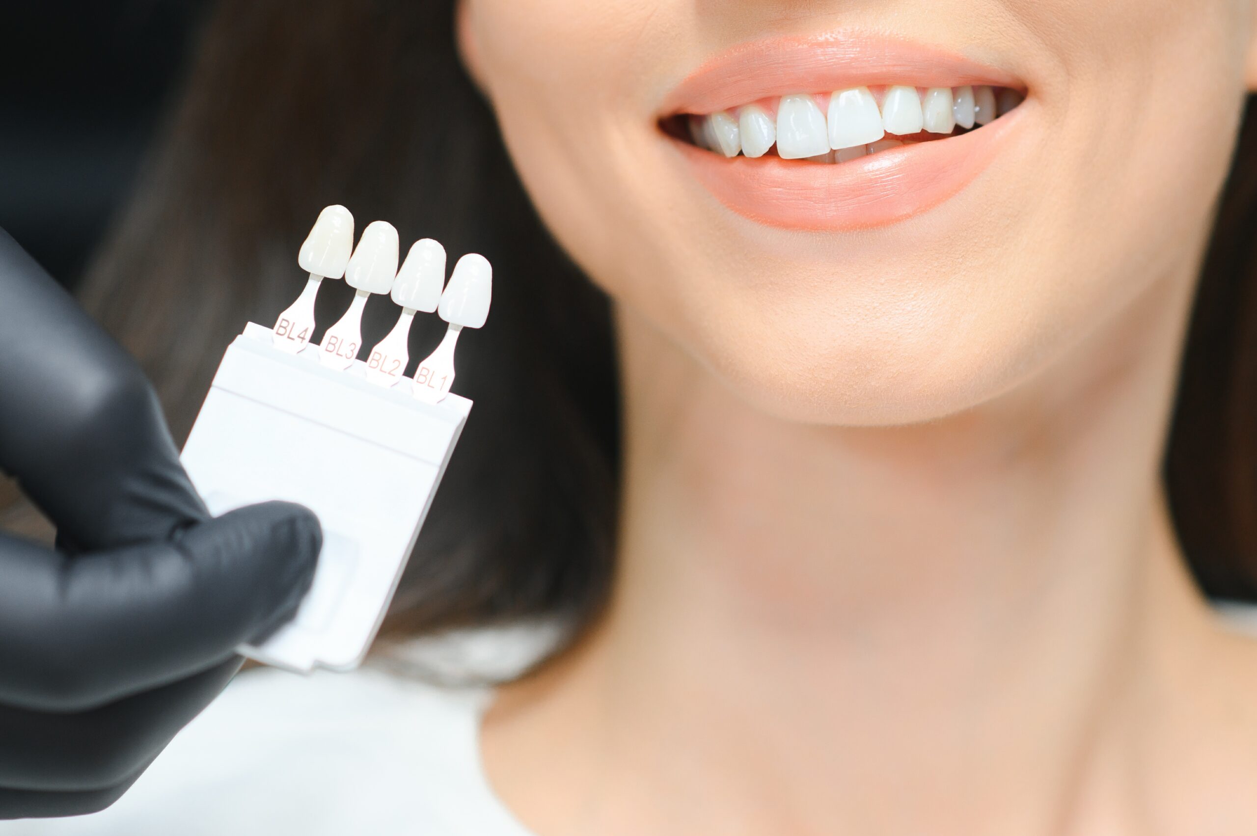teeth whitening strips