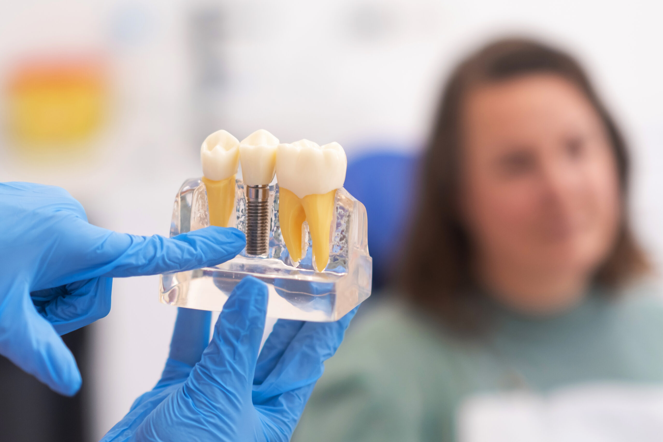 inexpensive tooth implants