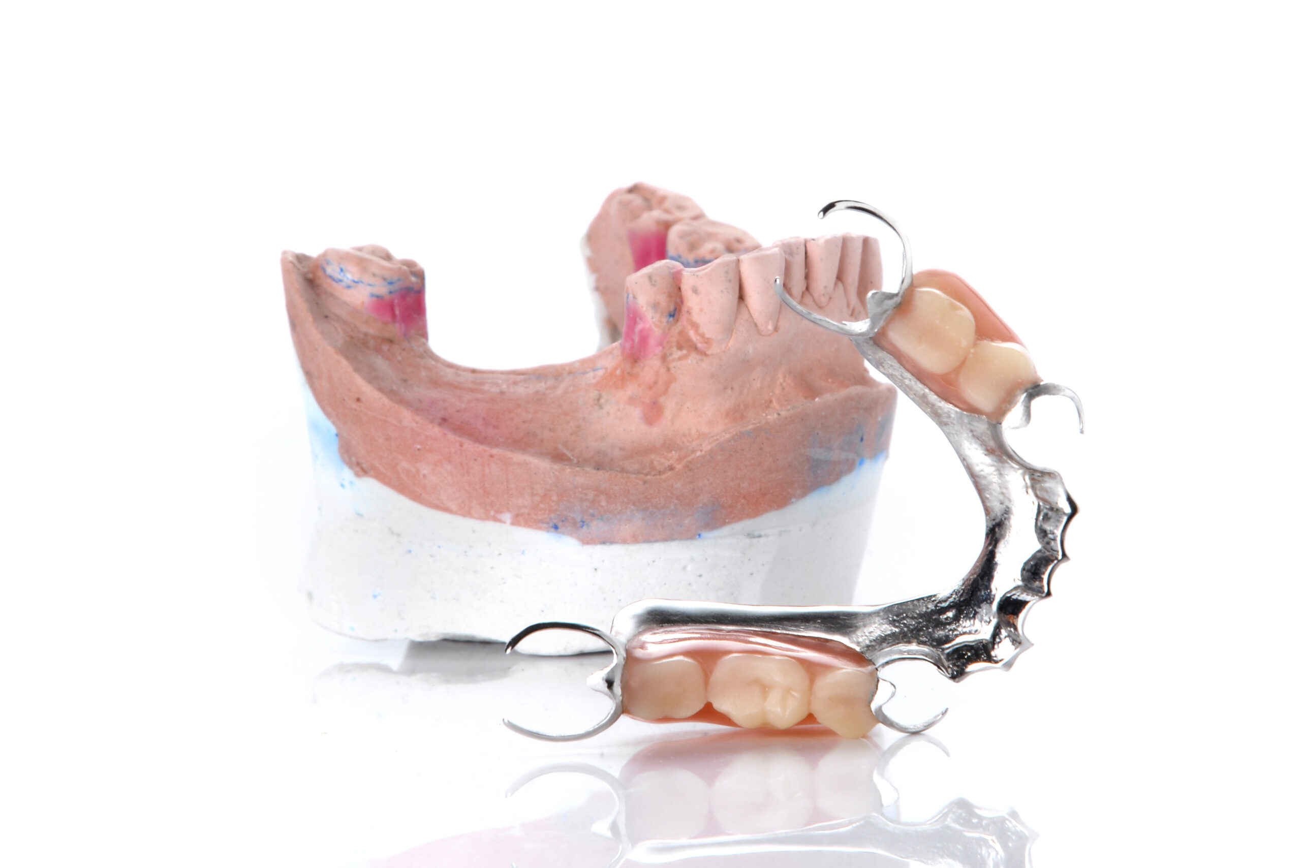 Partial Denture Cost