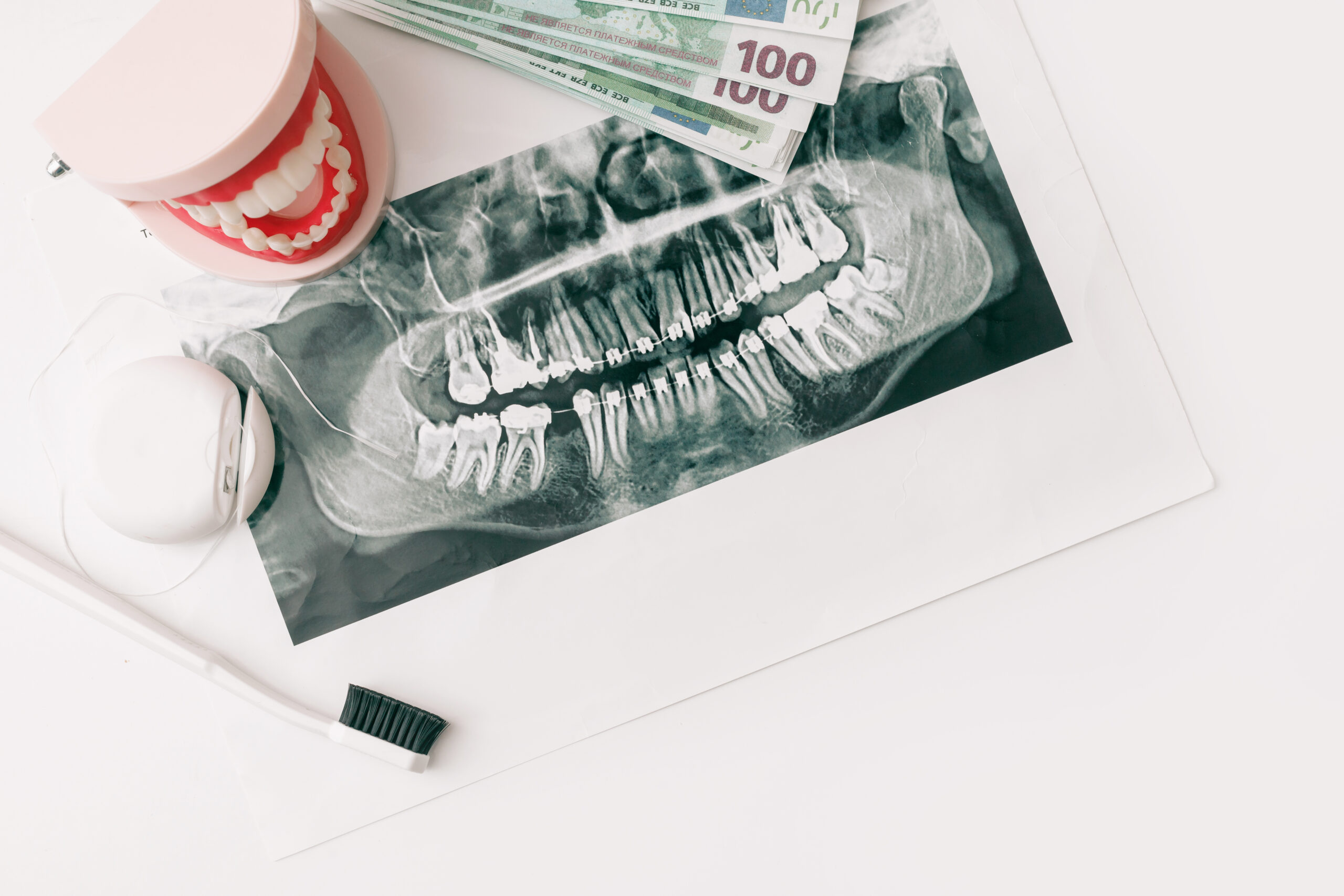 how much does an x ray cost without insurance