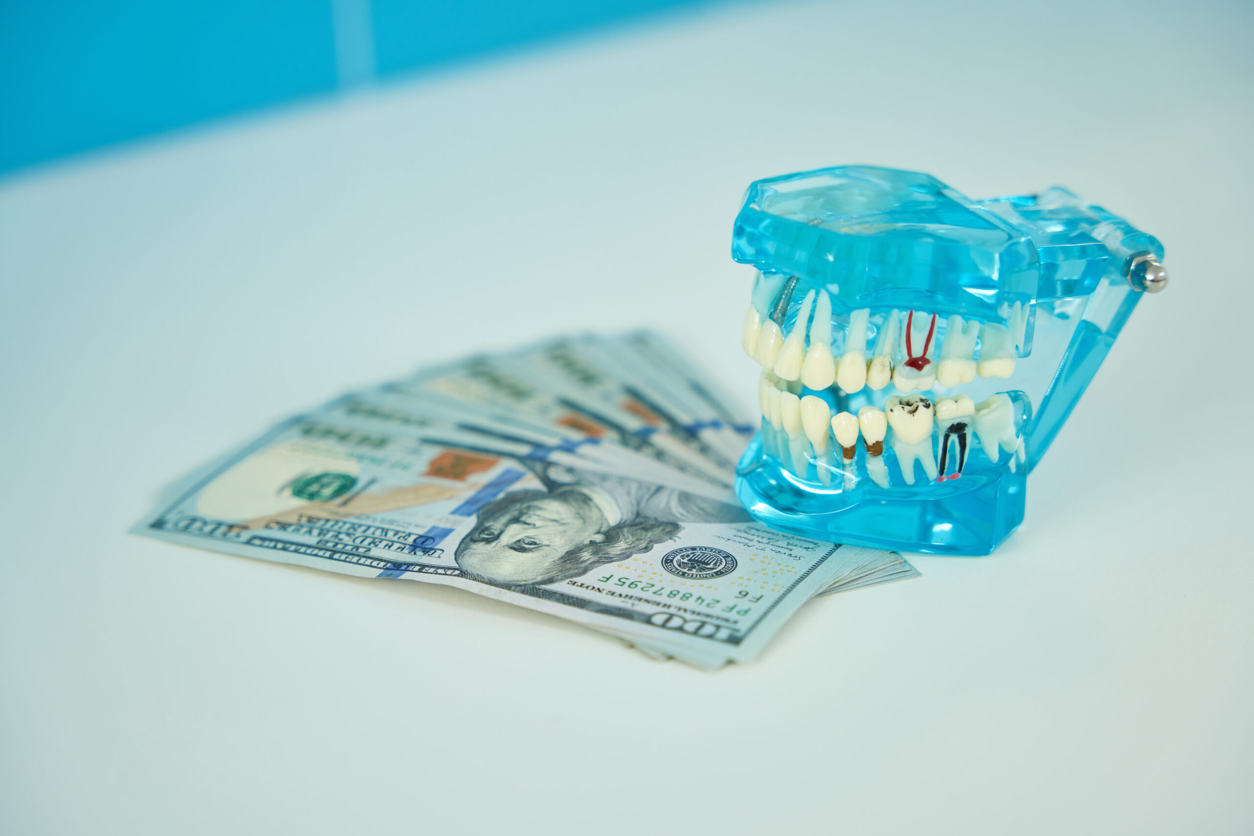 post and crown cost