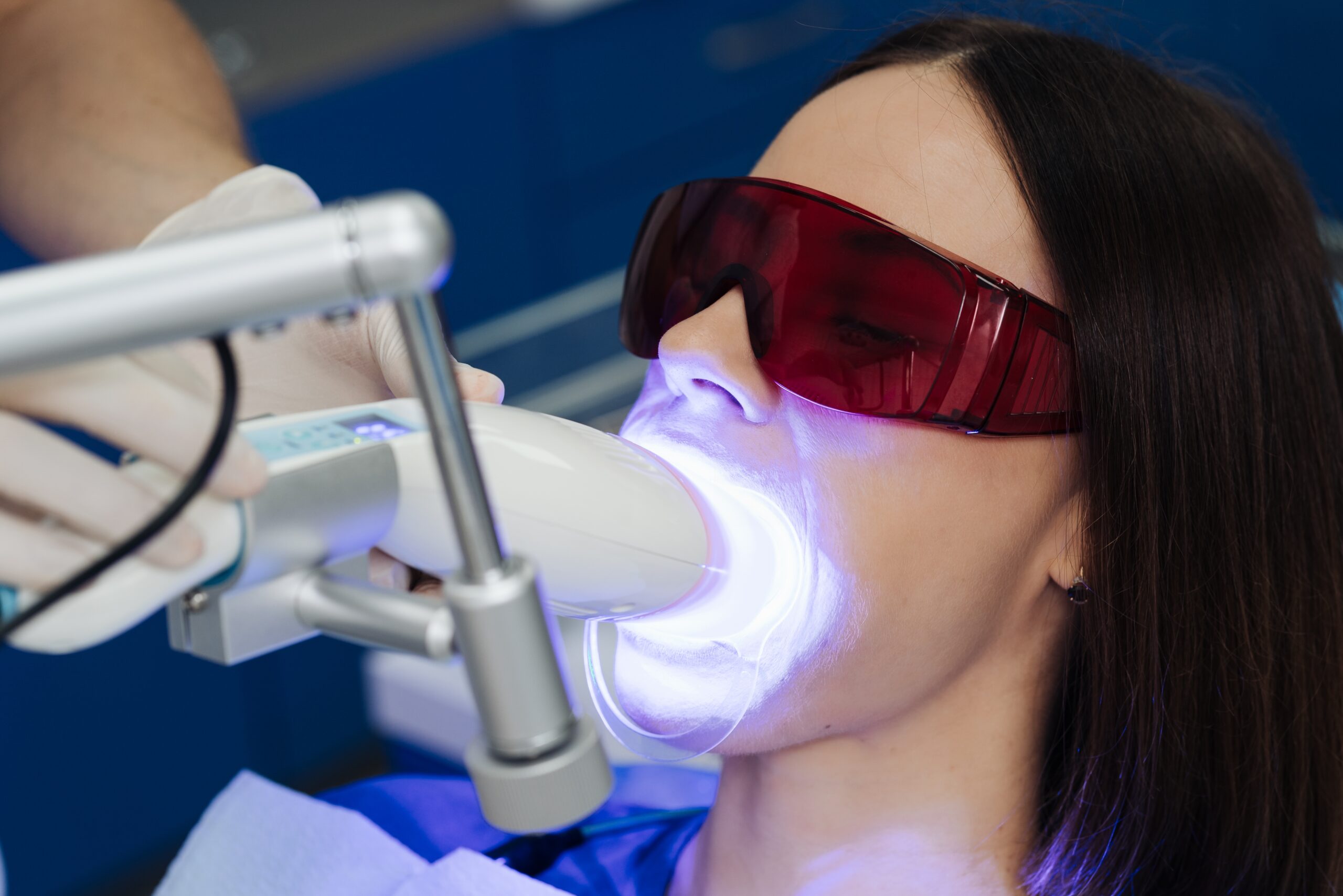 teeth whitening at dentist cost