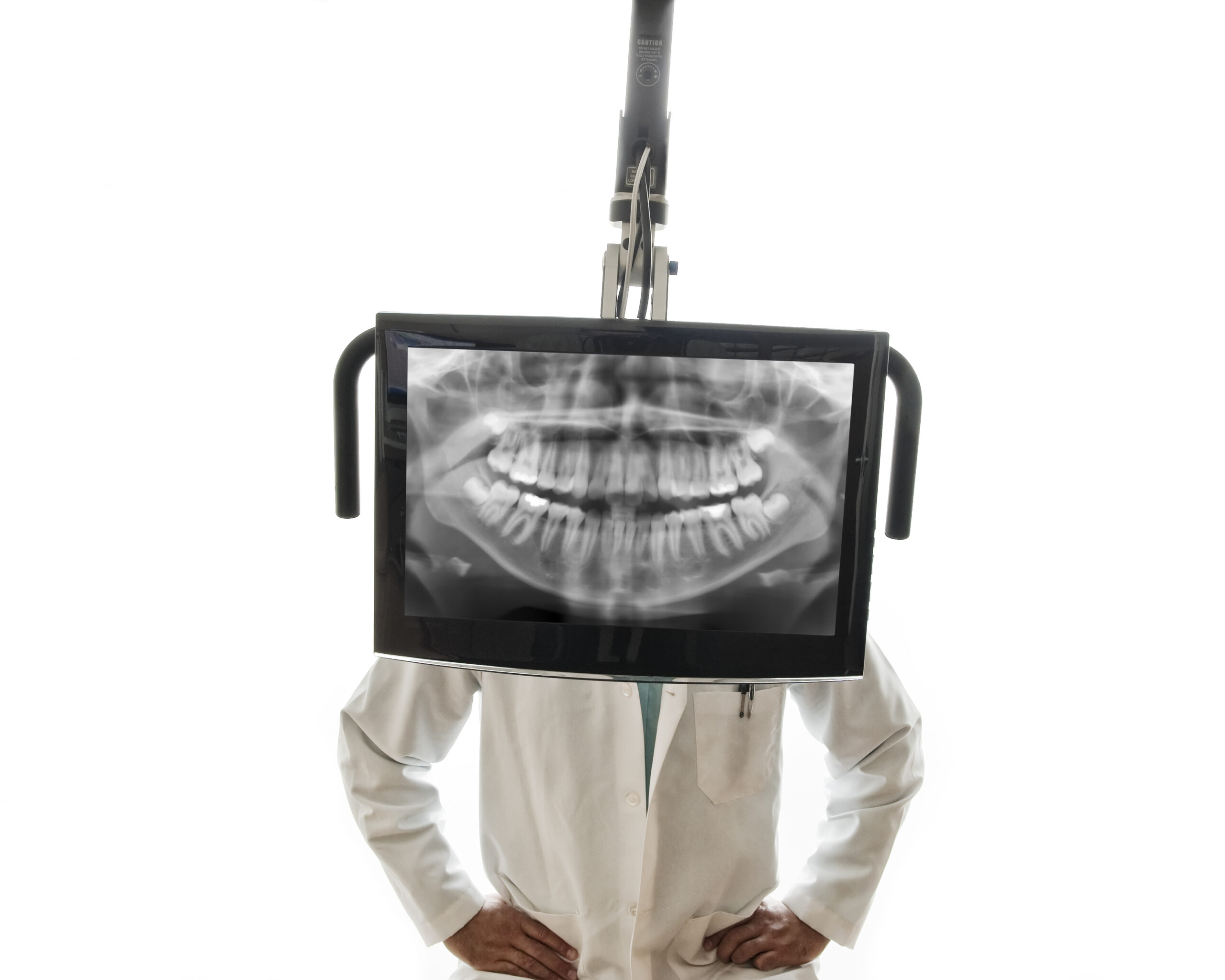 bitewing x-rays