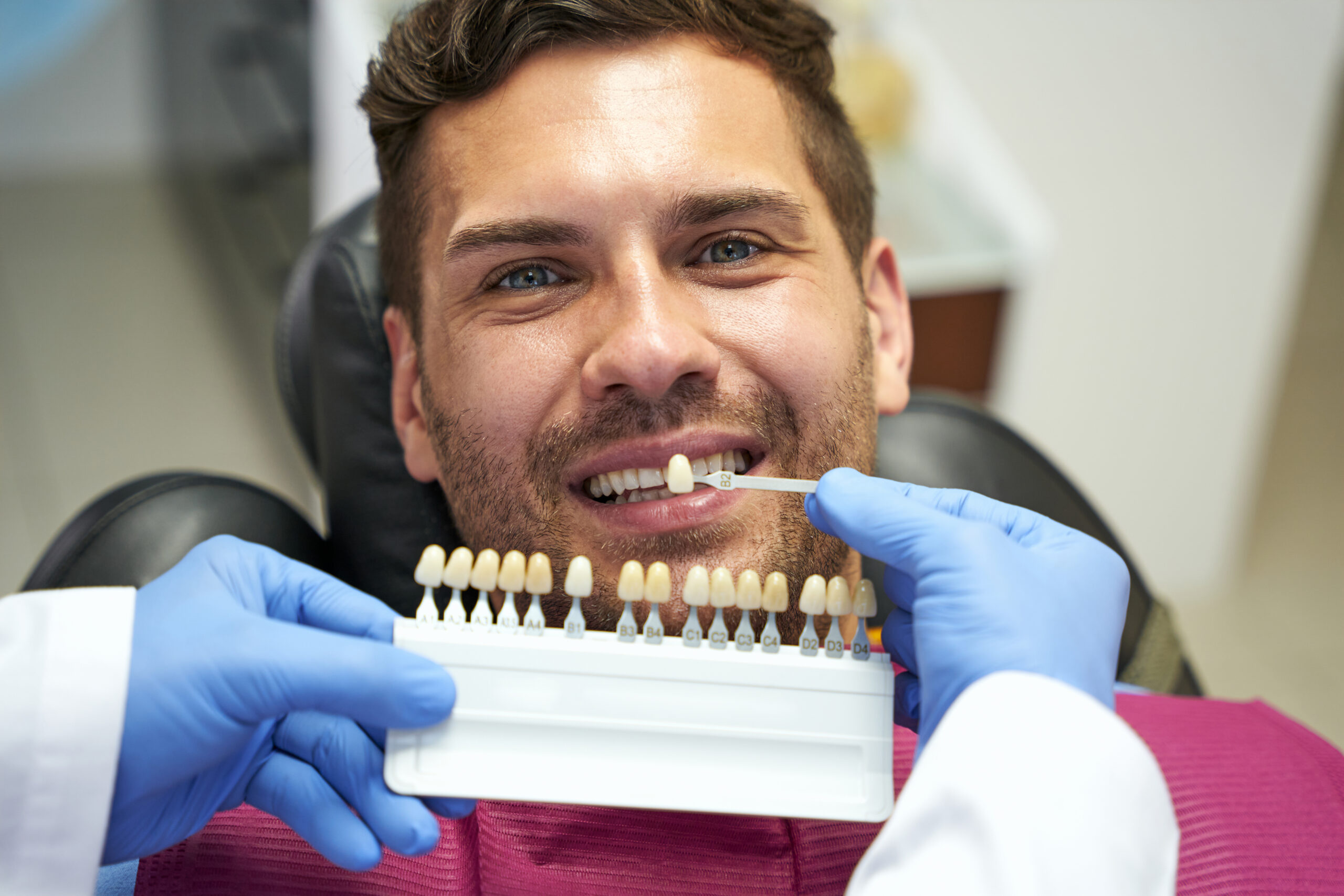 veneer teeth cost