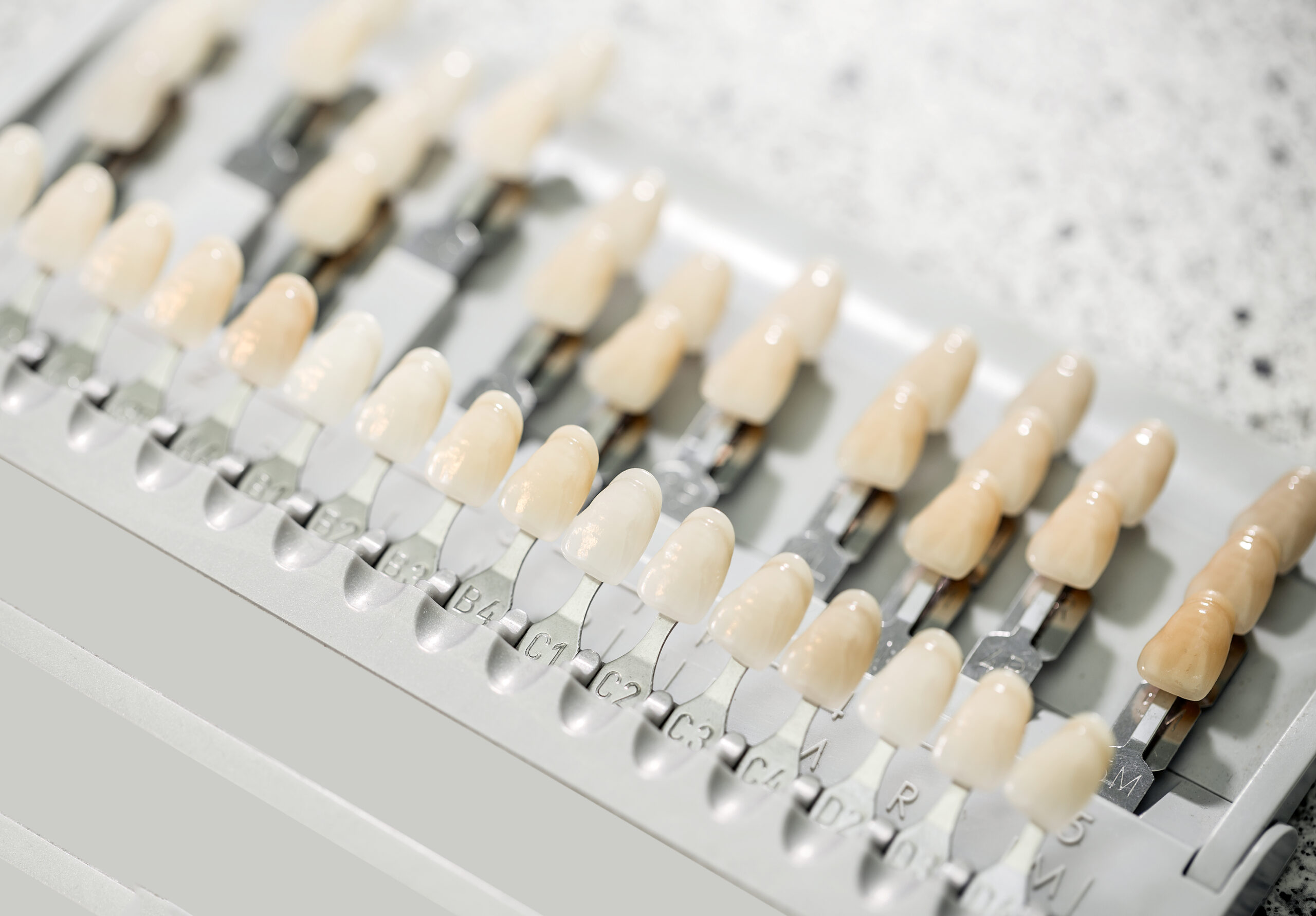 dentist implants near me