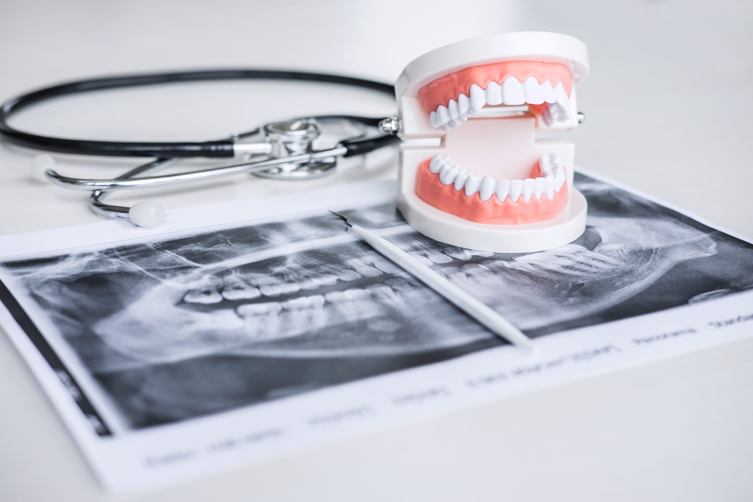 how much does an x ray cost with insurance