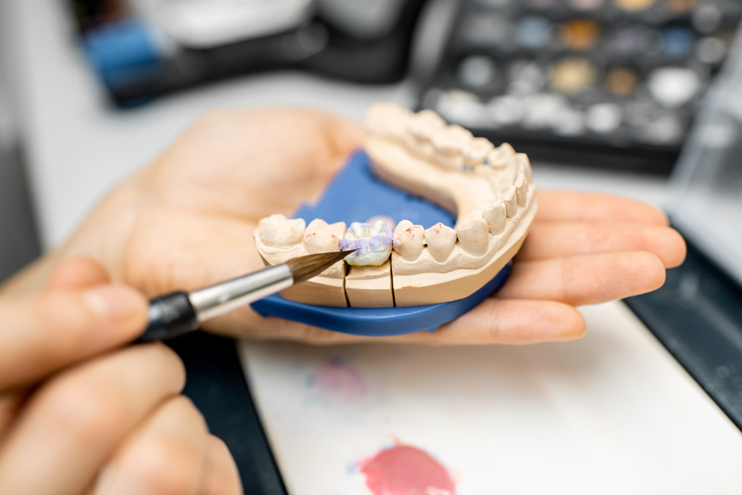 low cost dental crowns near me