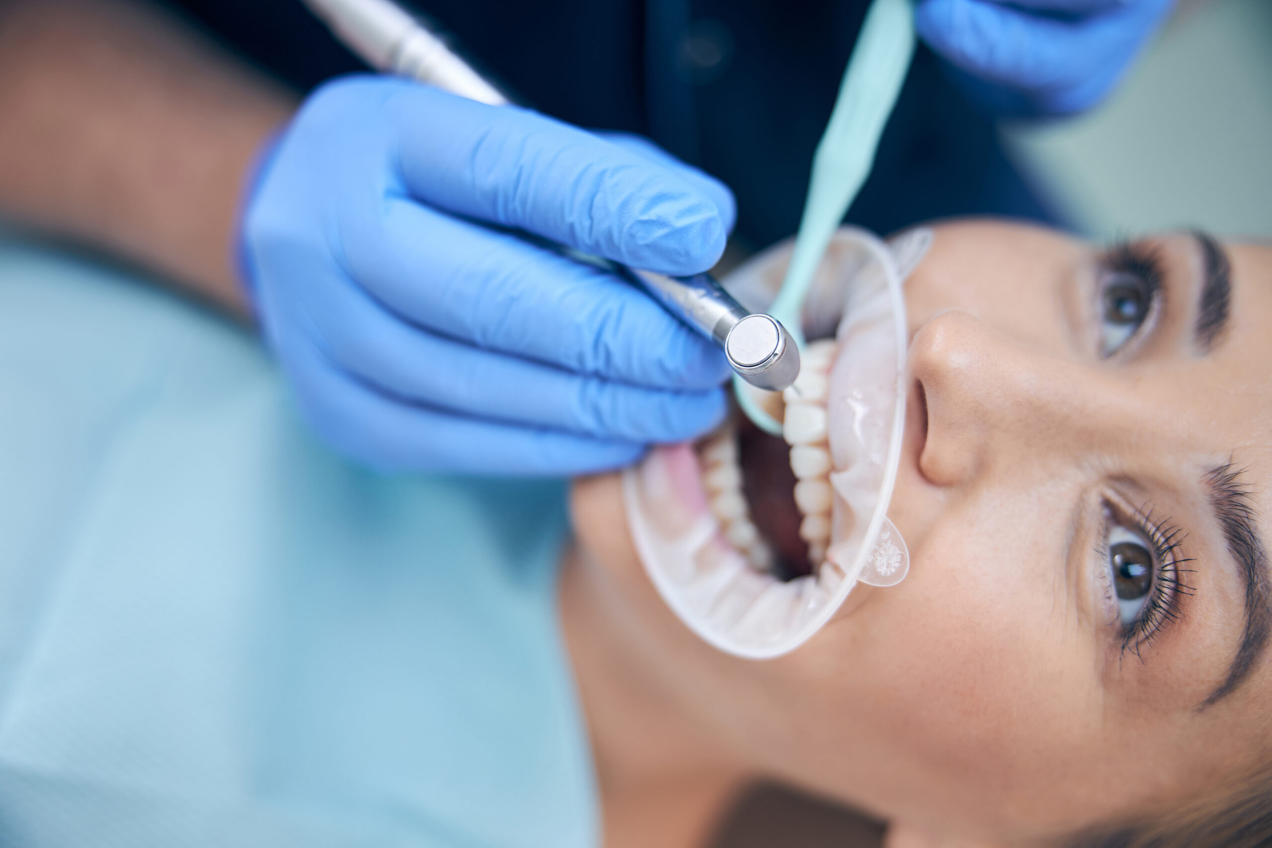 types of dental crowns and cost