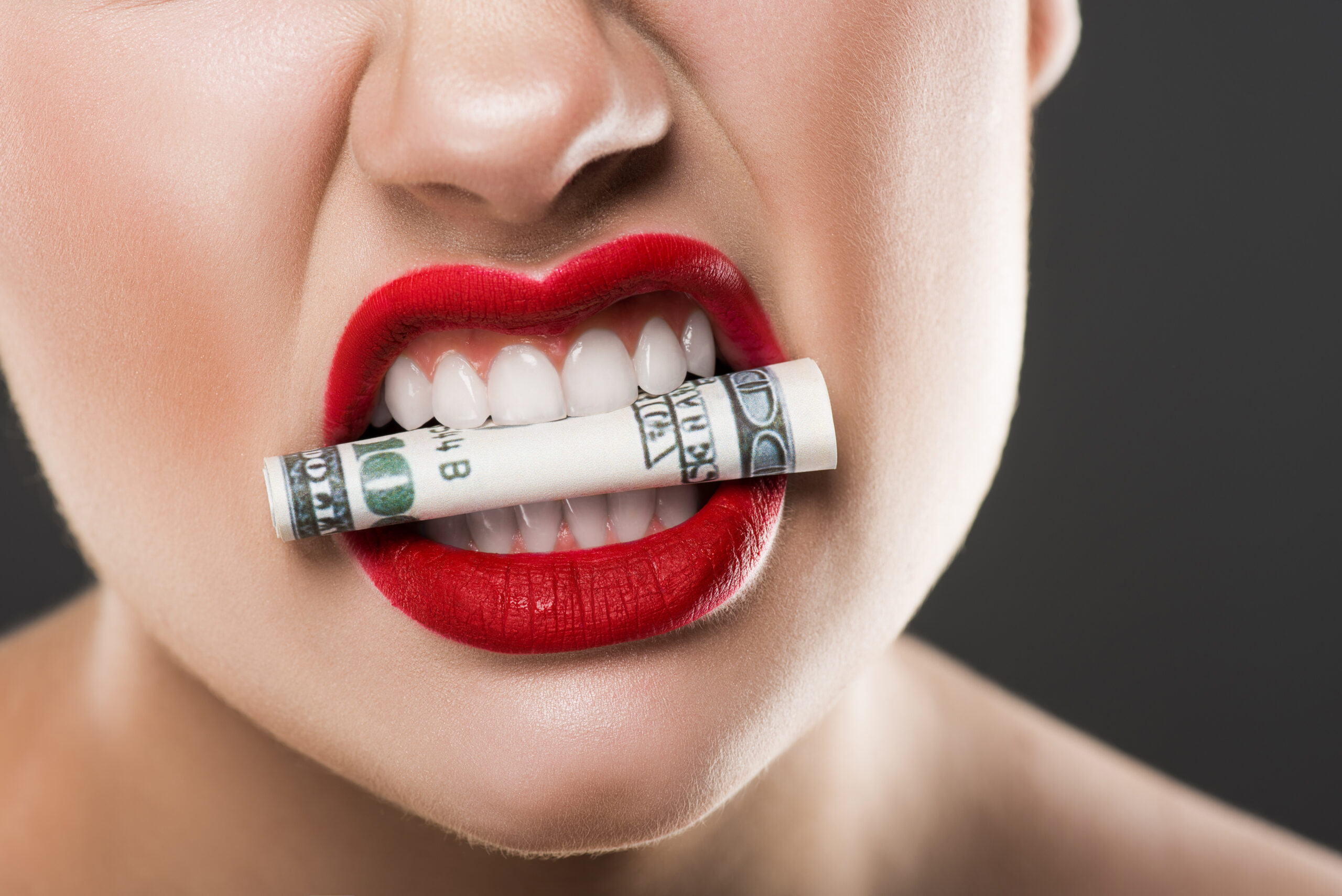 veneers price
