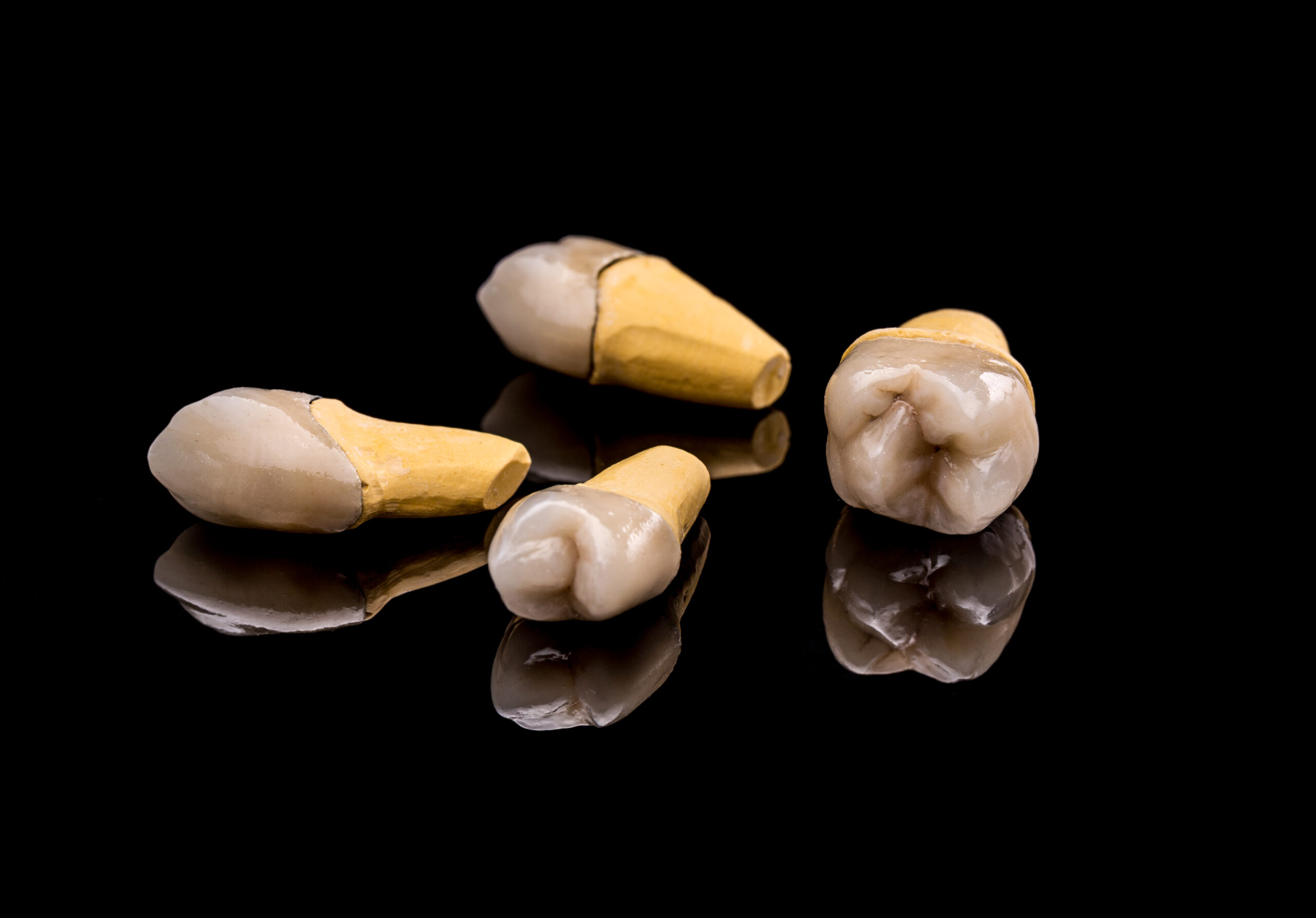 how much does a root canal and crown cost