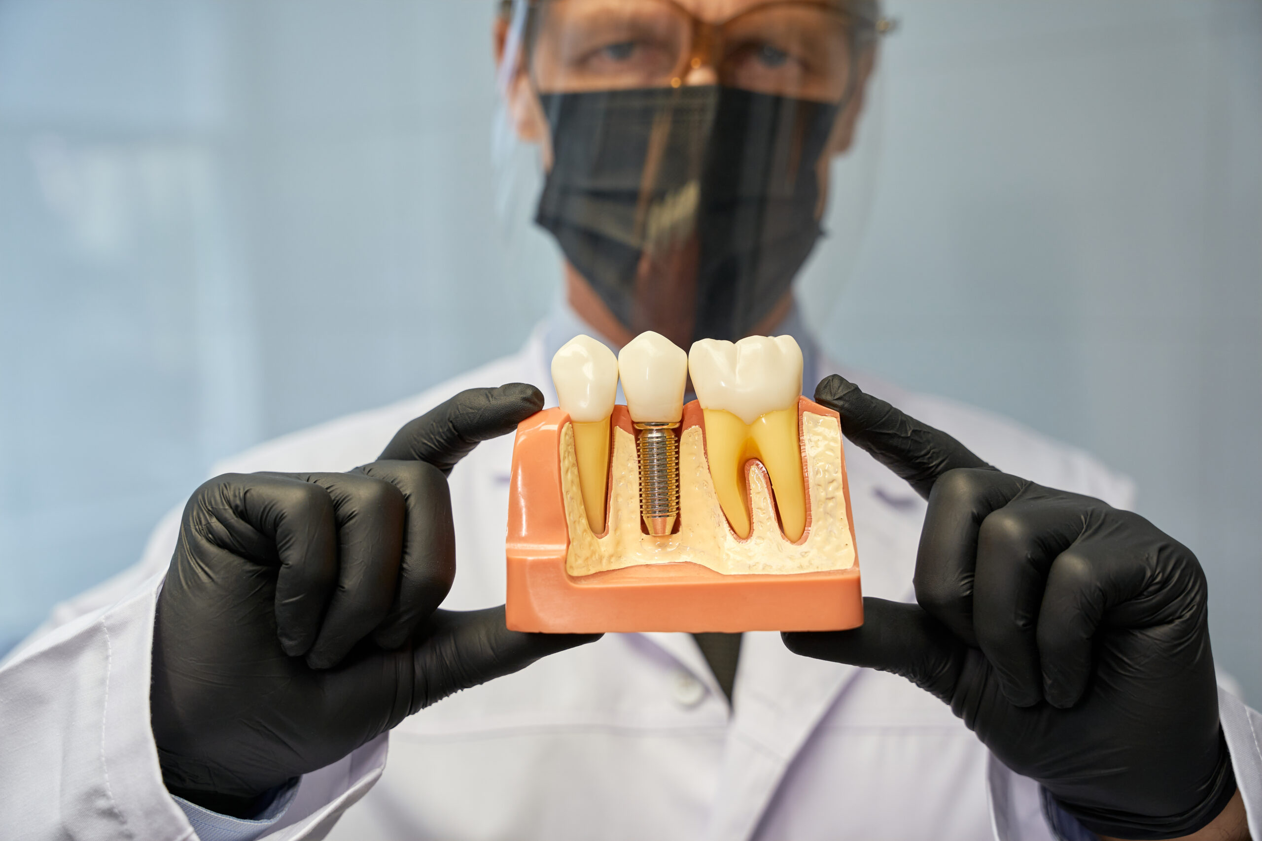 how to afford dental implants