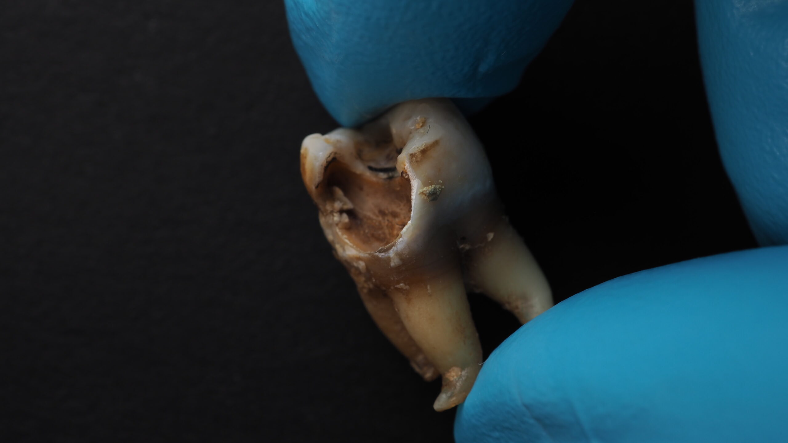 how much to fill a cavity