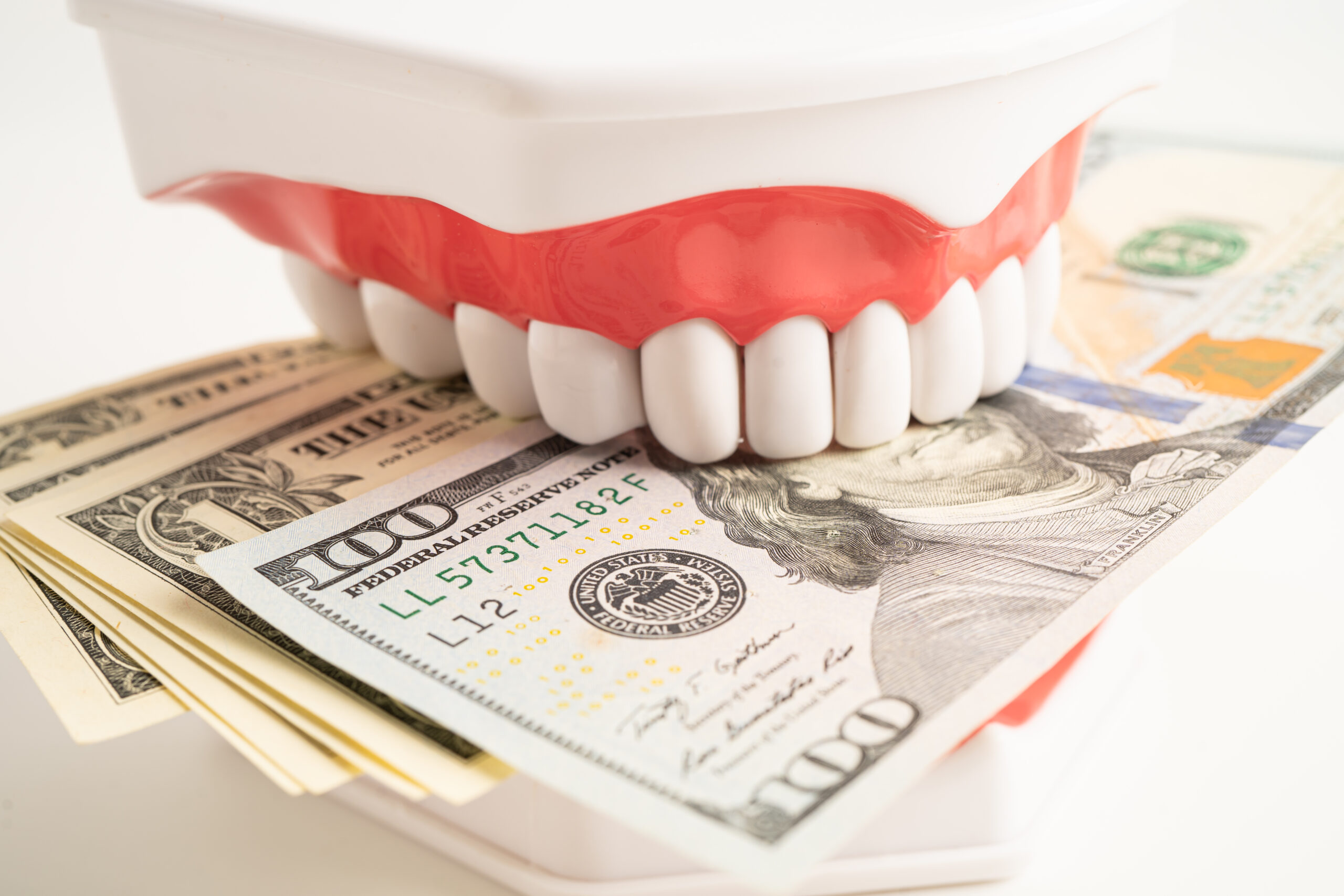 teeth whitening honolulu cost