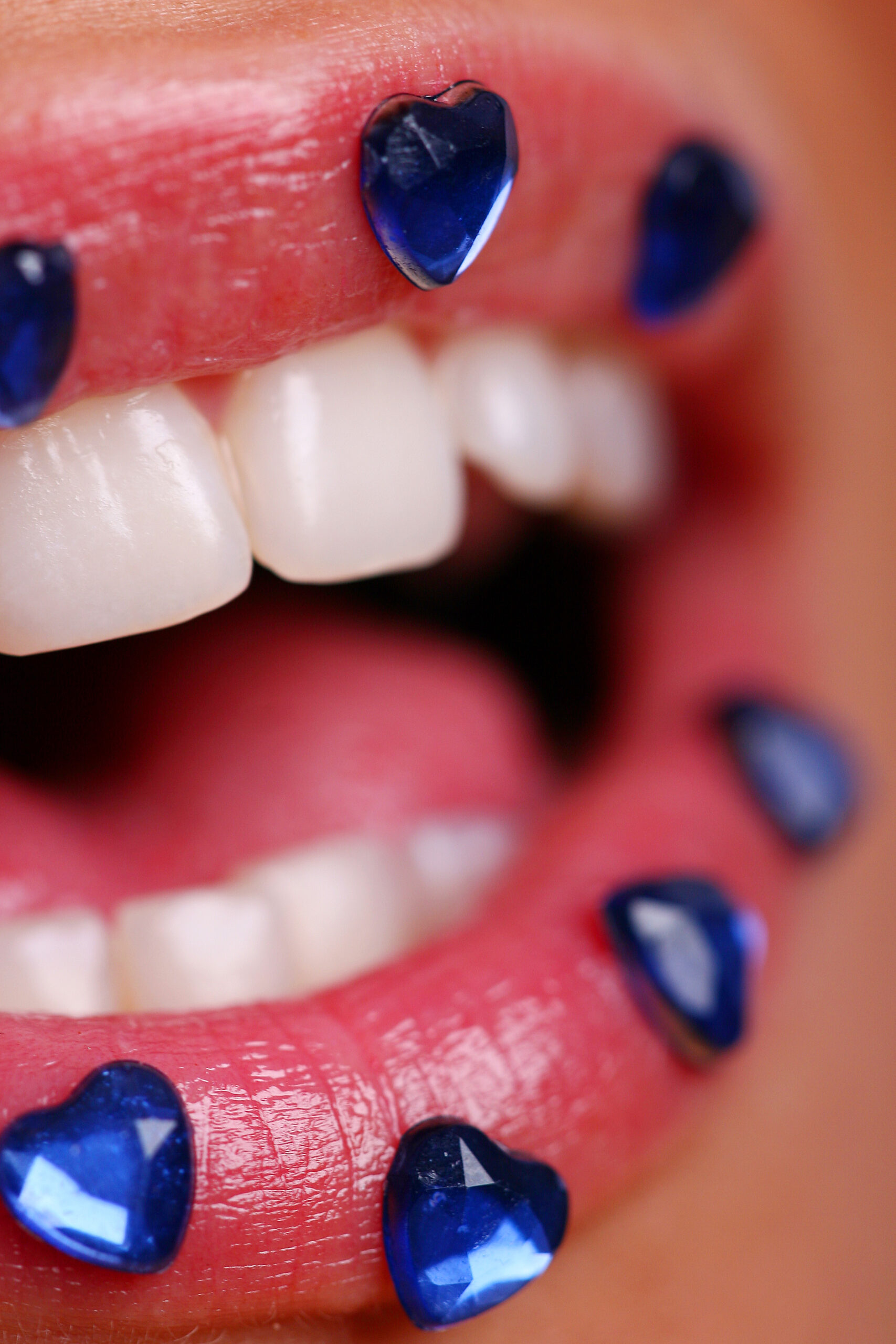 cost for veneers