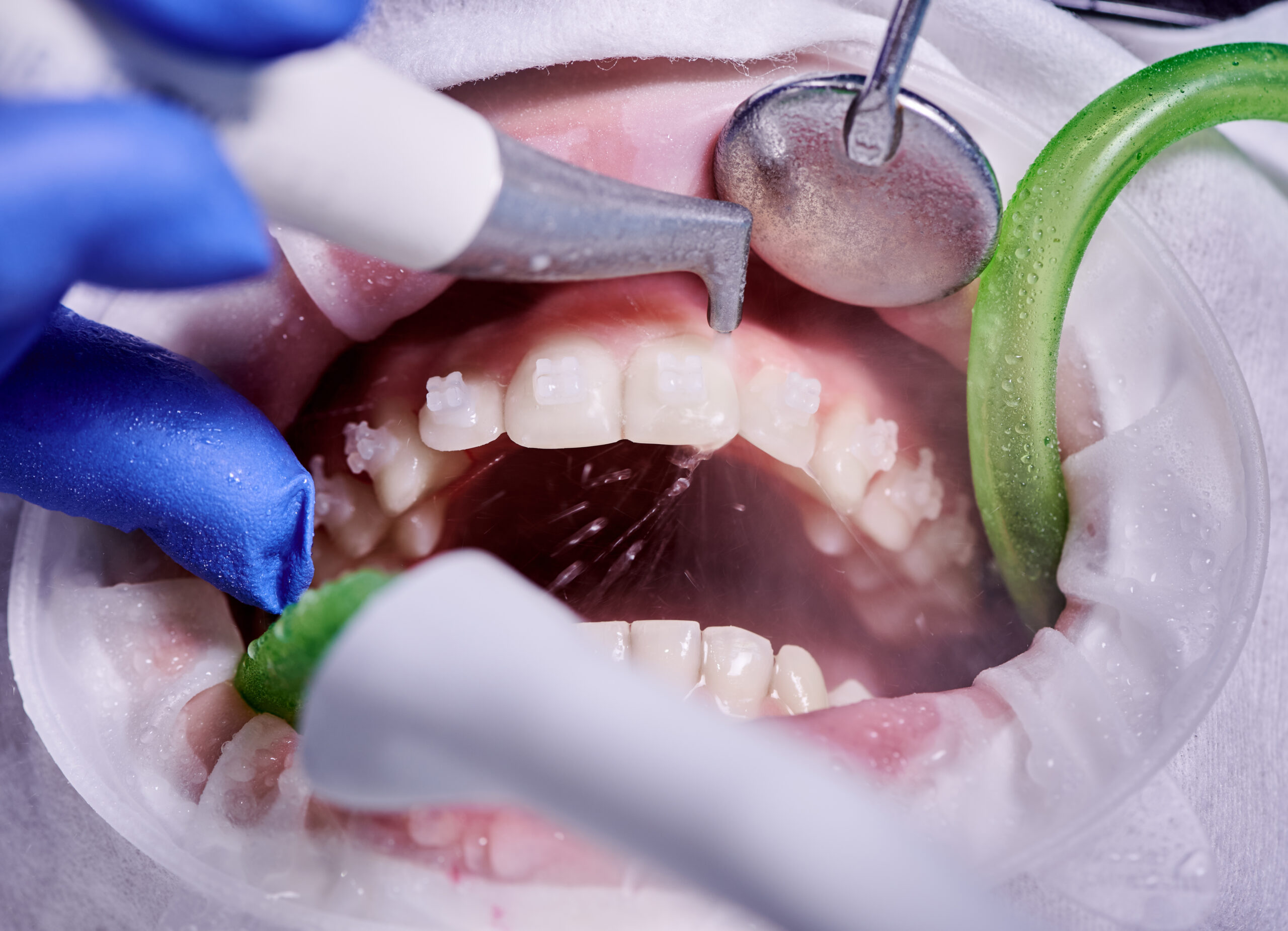 emergency dentists near me