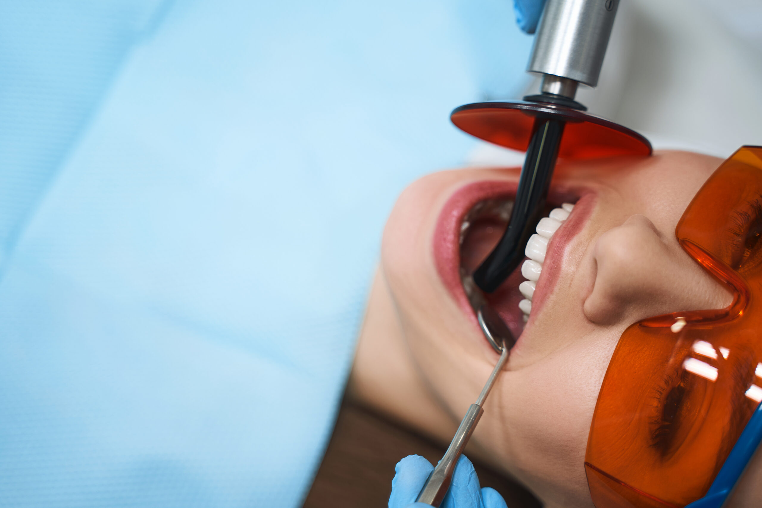 how much does it cost to fill a cavity without insurance?