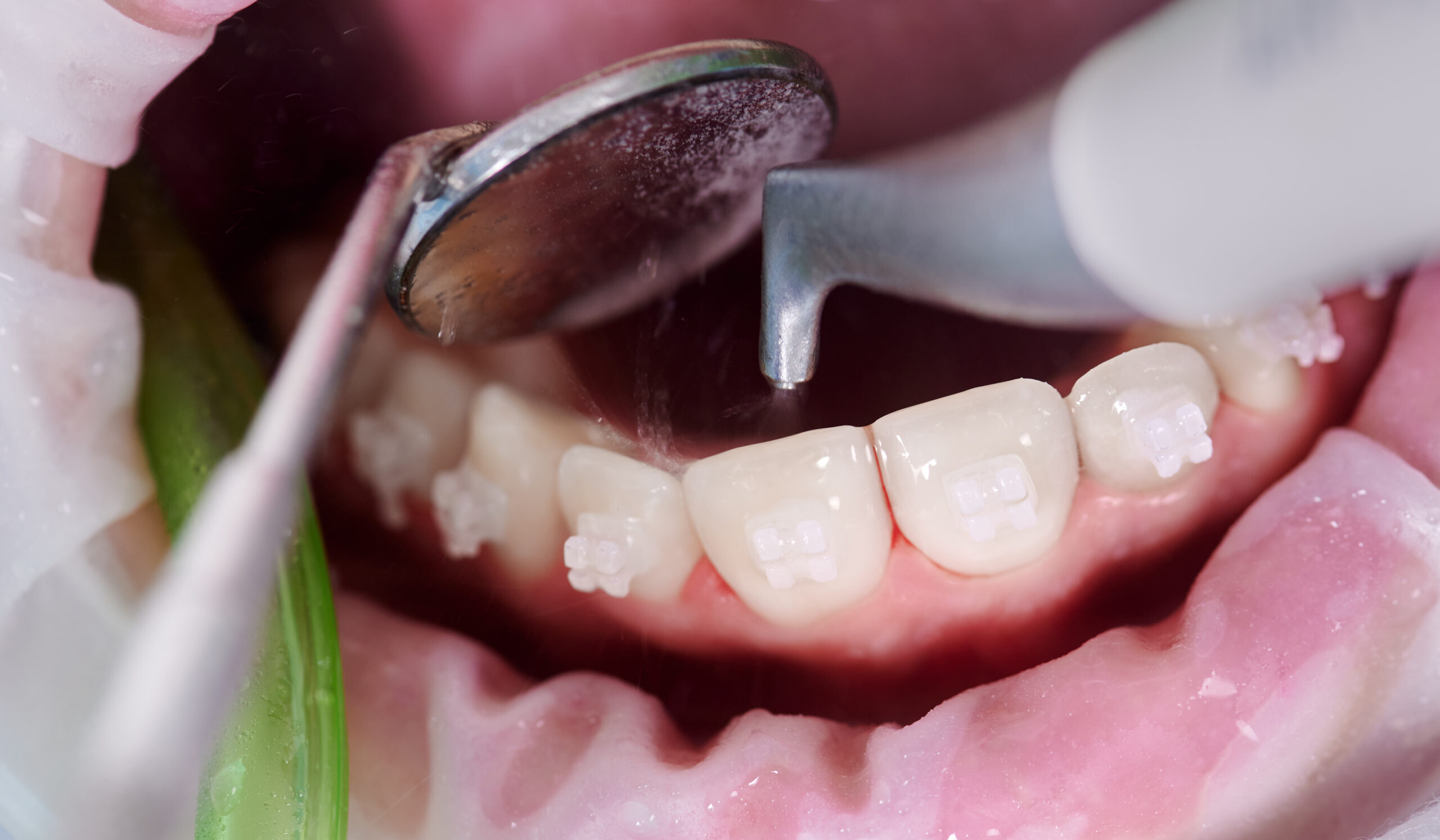 bottom front teeth hurt