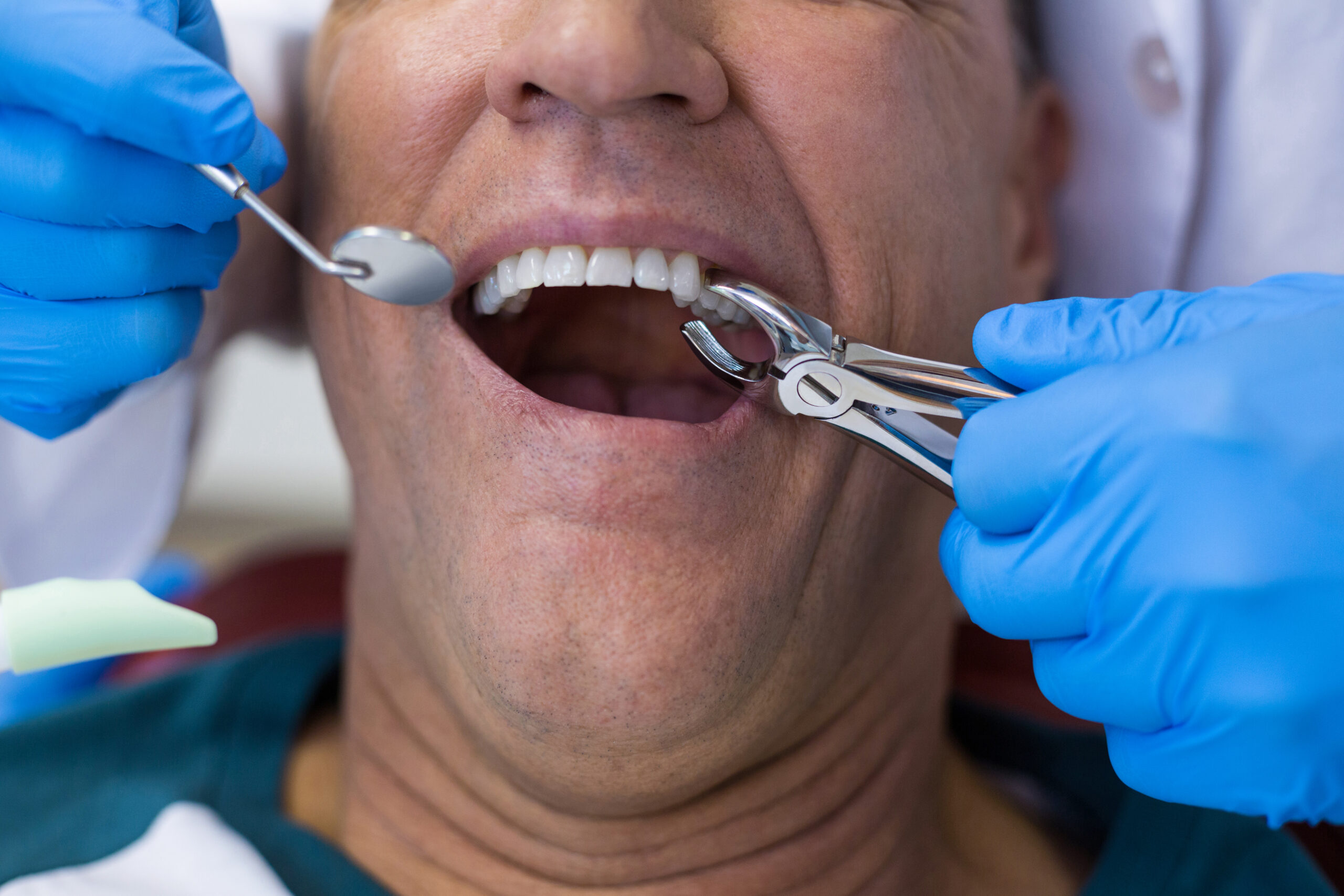 An emergency tooth extraction with no insurance