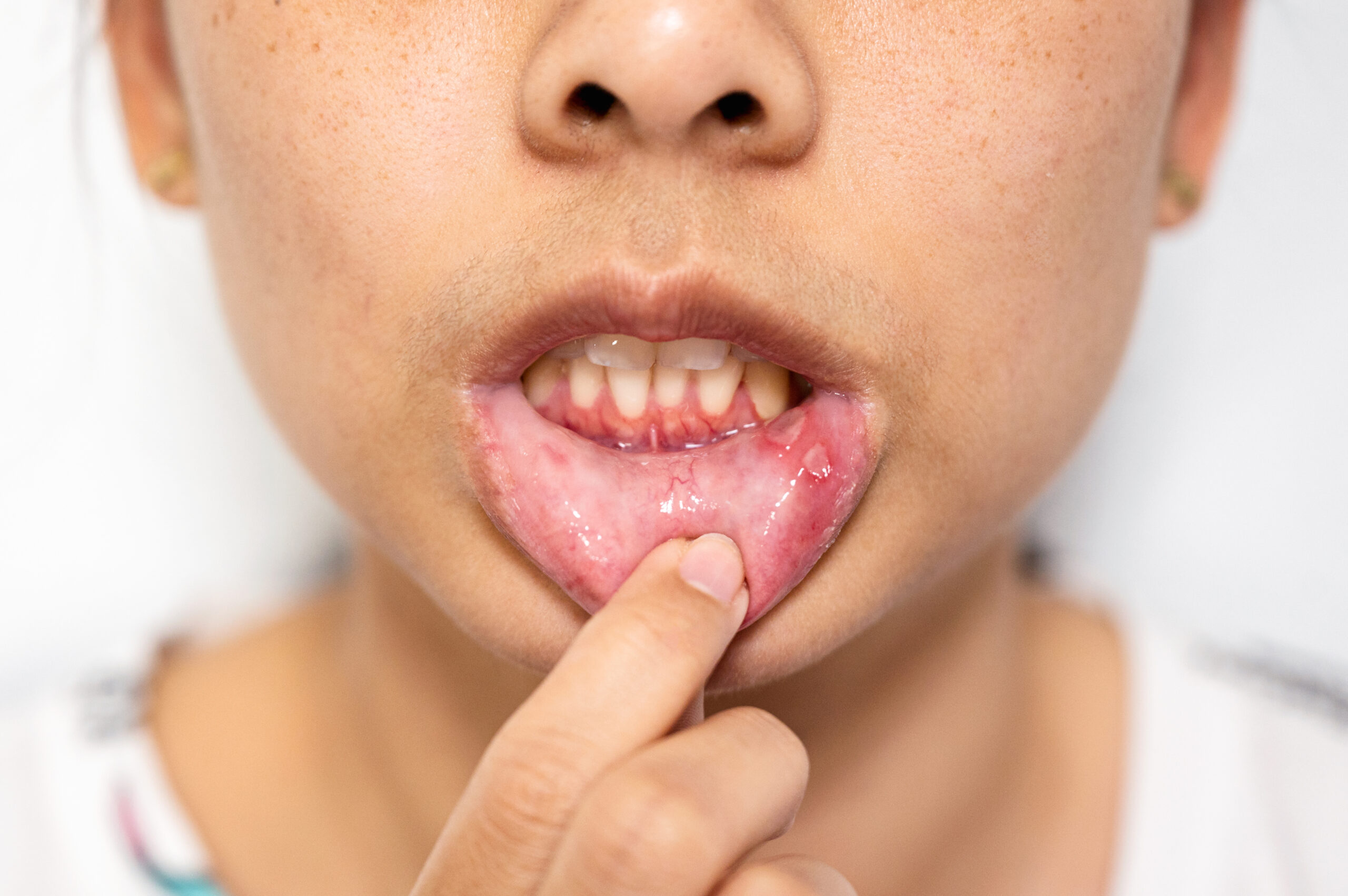 A woman experiencing throbbing gums