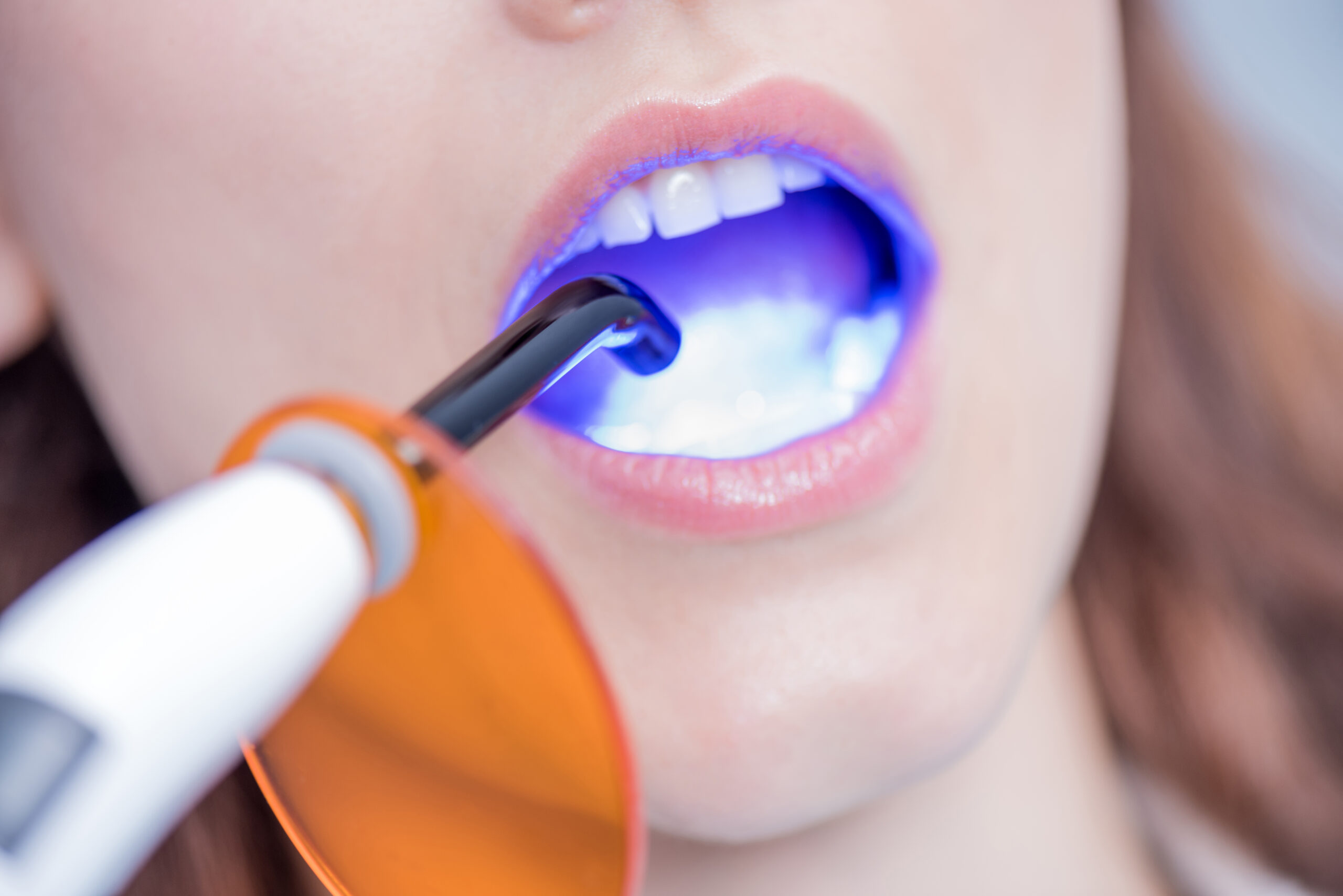 A teeth whitening light being used on a woman