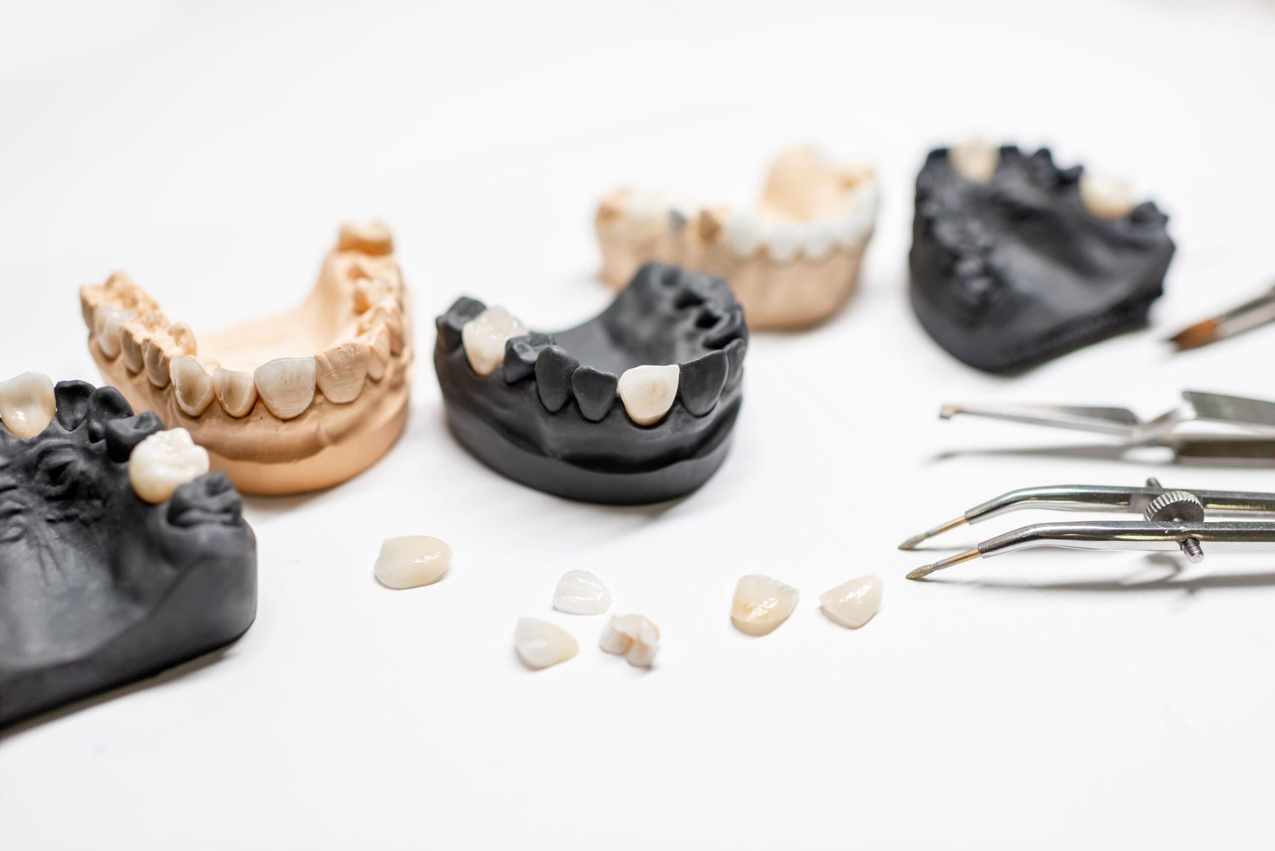 A synthetic jaw with black teeth.
