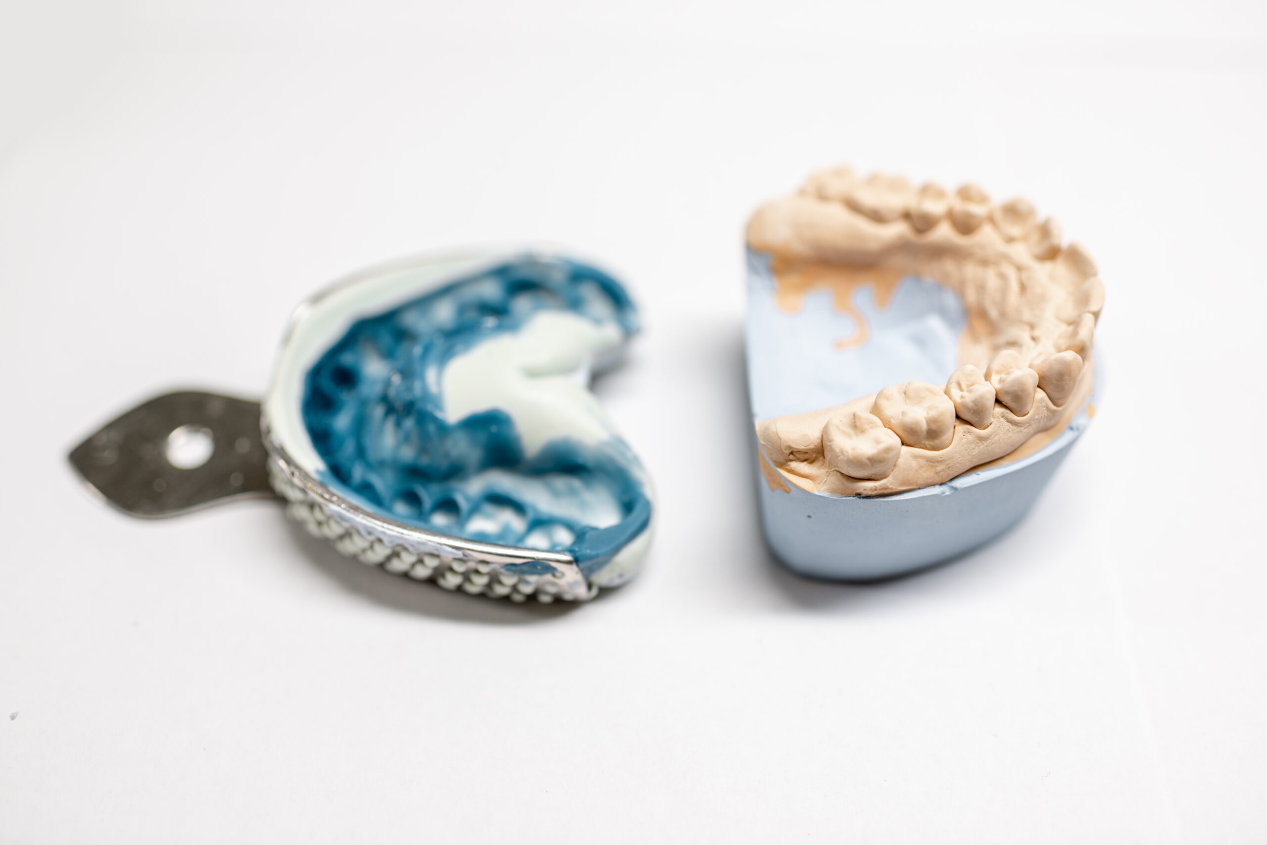 A blue teeth impression.
