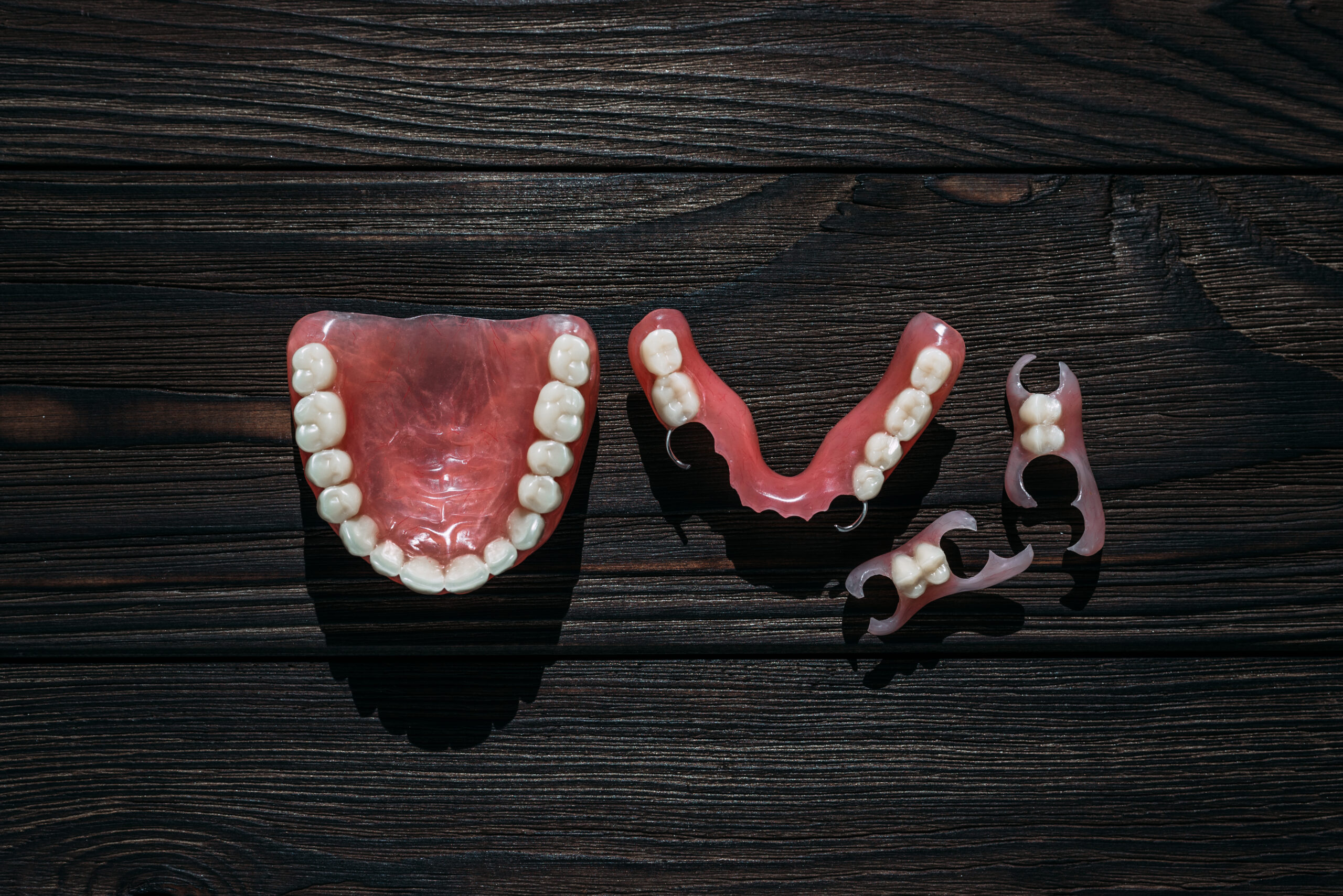 An example of how to fix a tooth that fell out of dentures.