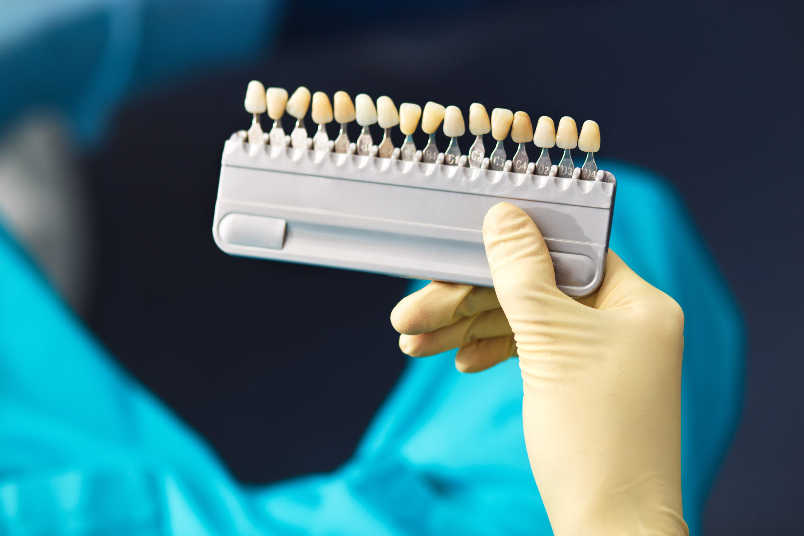 An example of tooth colors, including c1 tooth color.