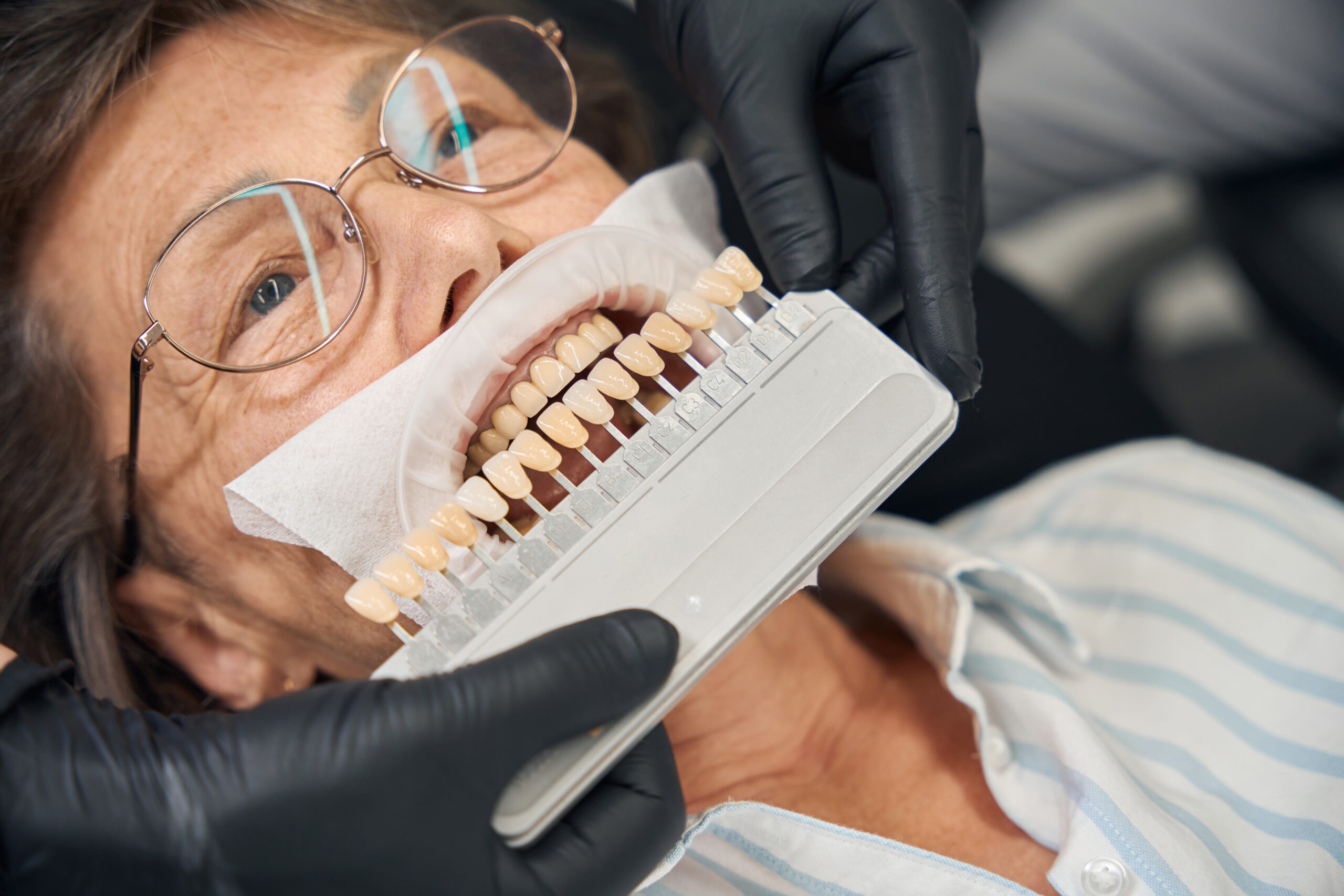 An elderly woman's teeth being compared to a denture color chart.