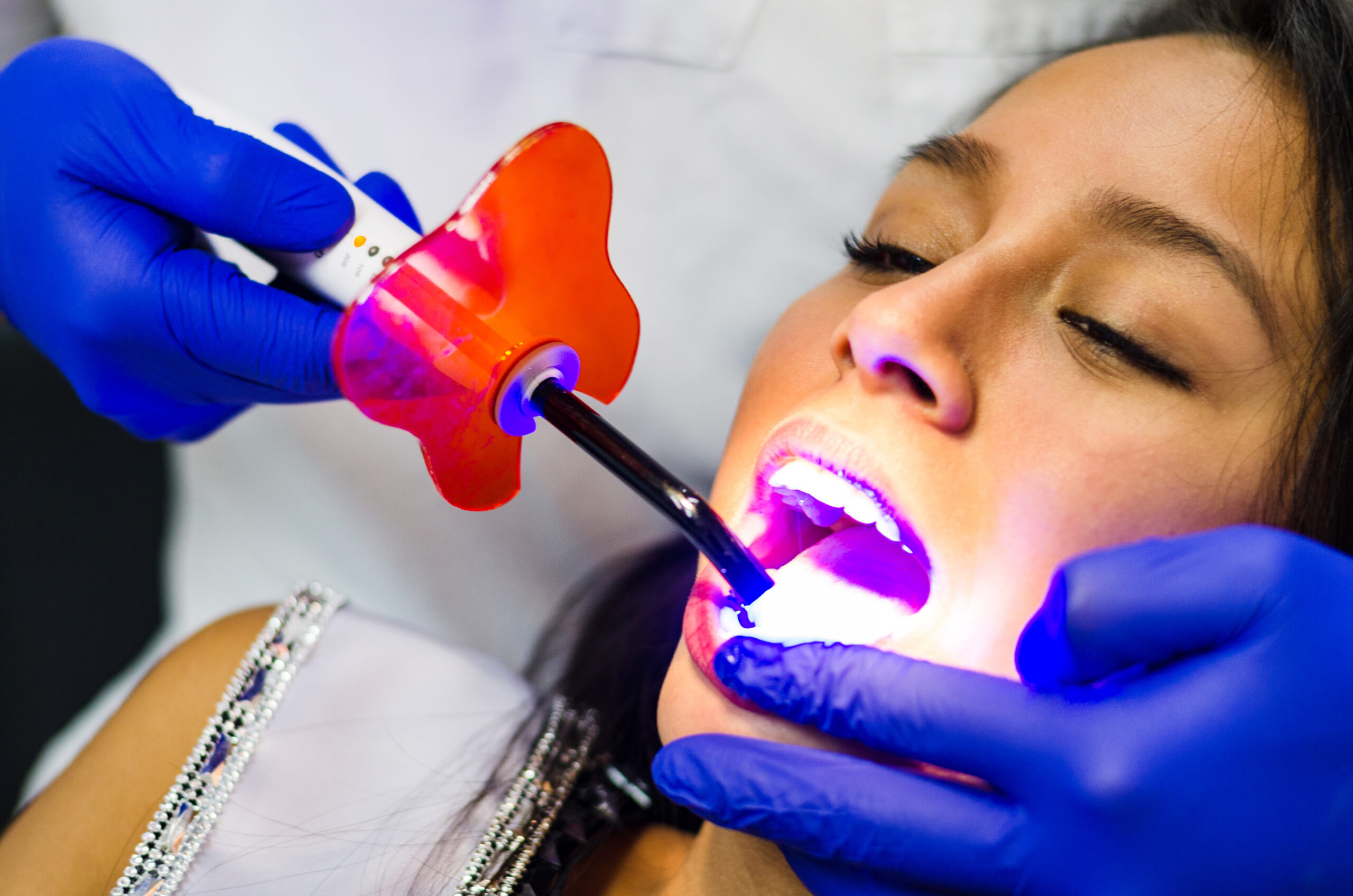 A woman receiving teeth whitening in Birmingham, AL.