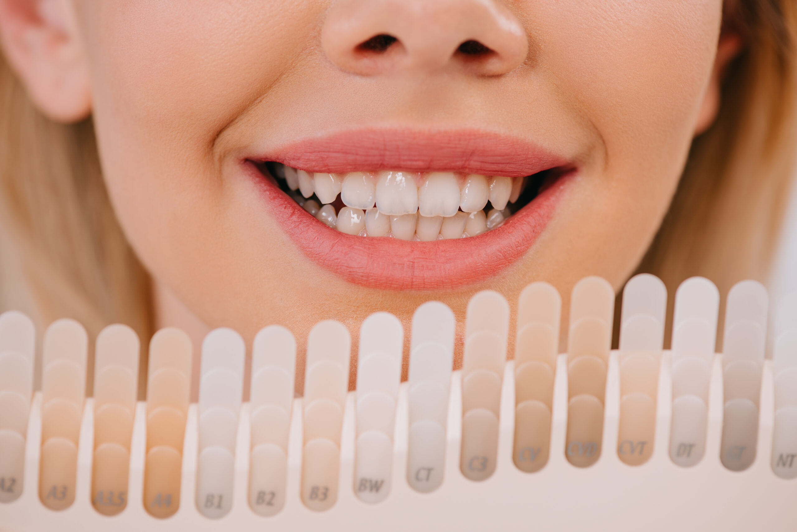 A woman comparing her tooth color to a shade guide.