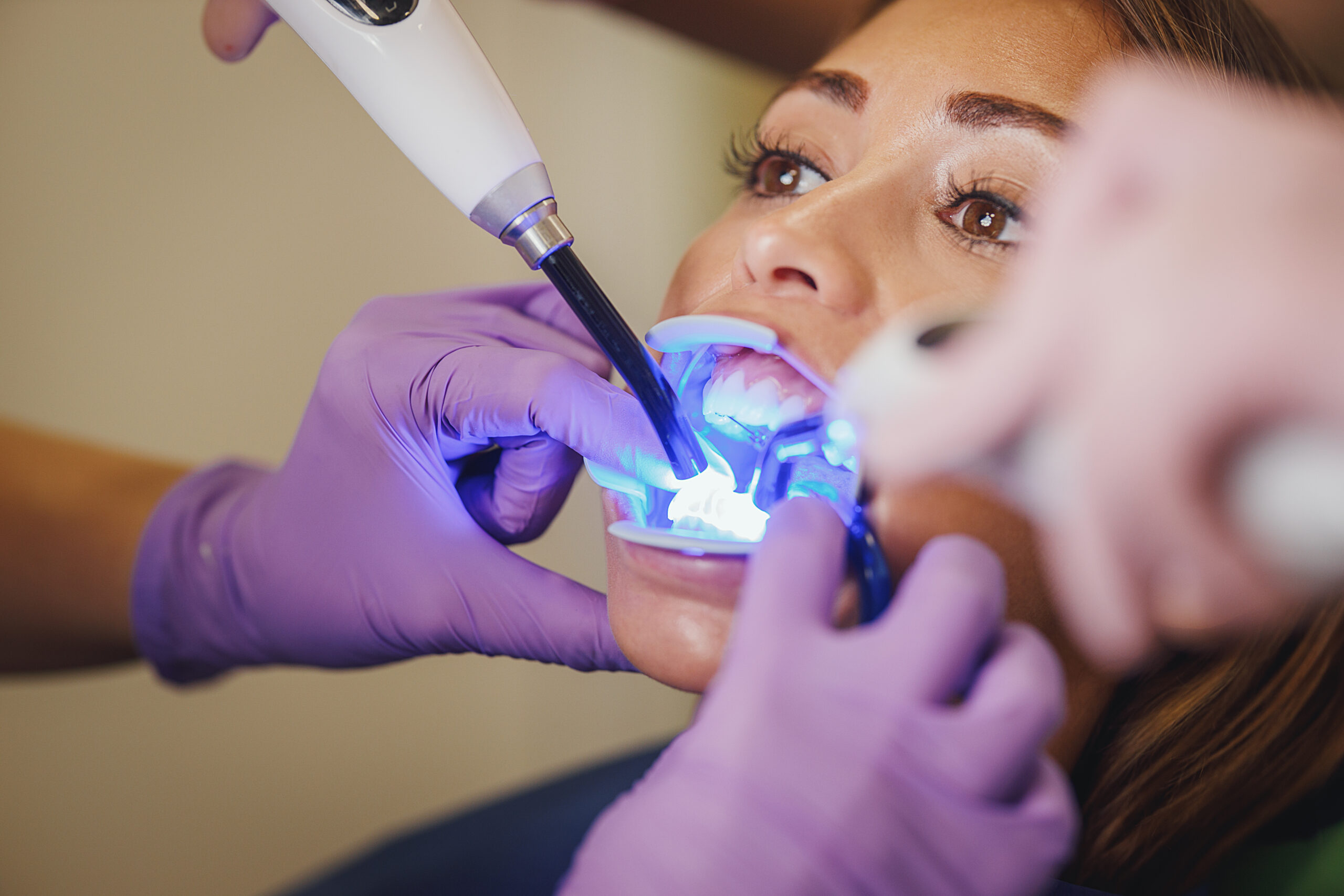 teeth whitening rotherham