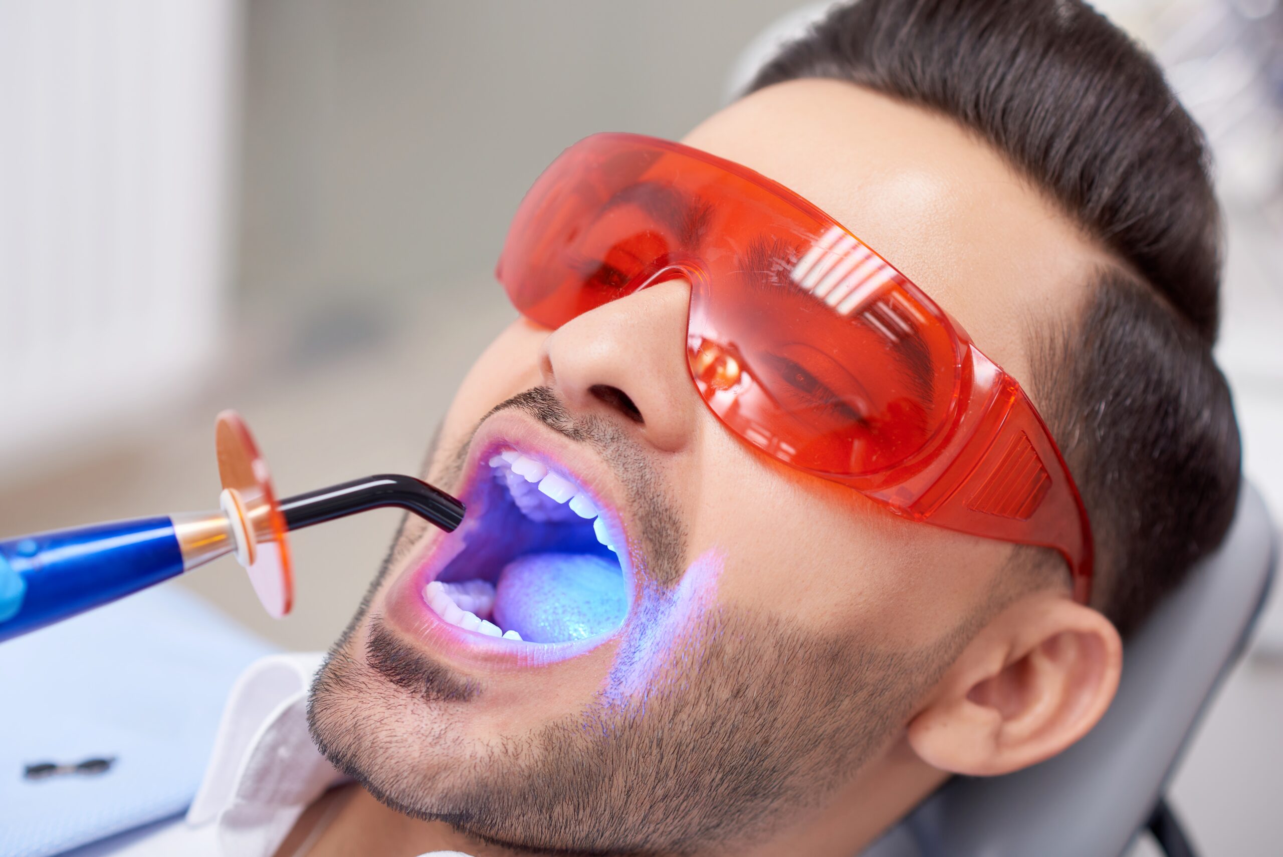 A man receiving teeth whitening in Burnaby.