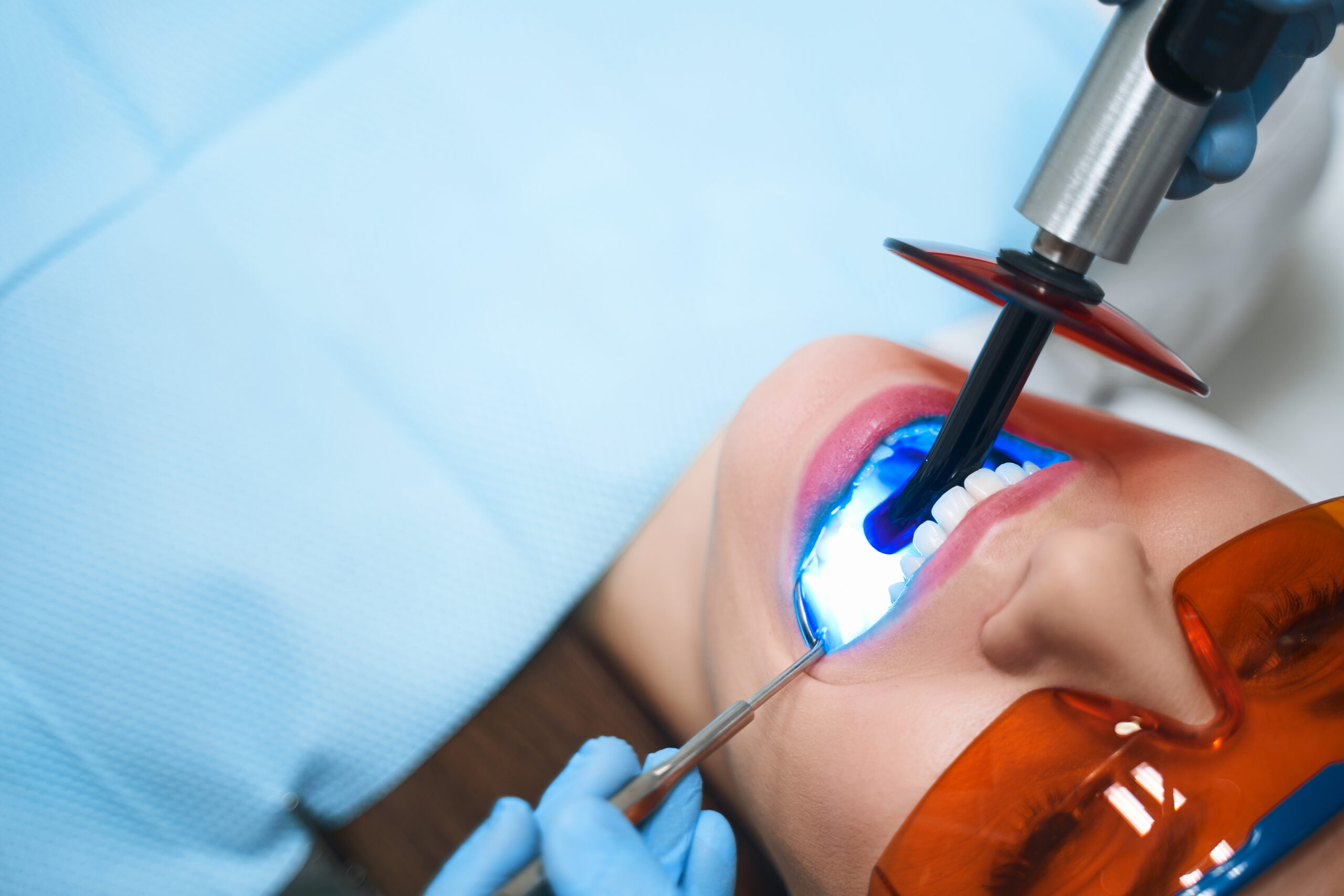 teeth whitening raleigh nc cost